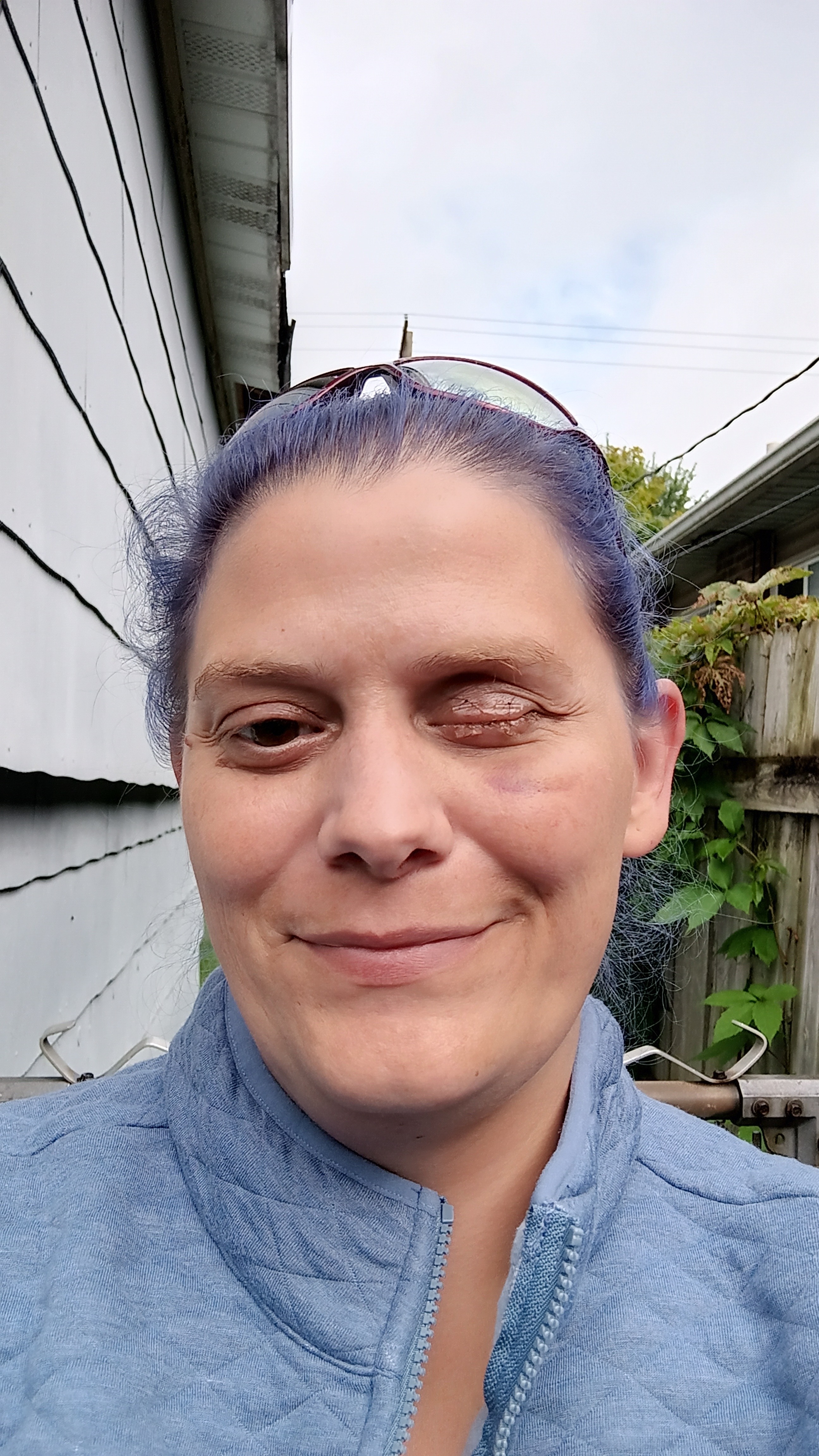 Help Connie cover Surgery Costs from eye removal campaign photo, 6 of 8