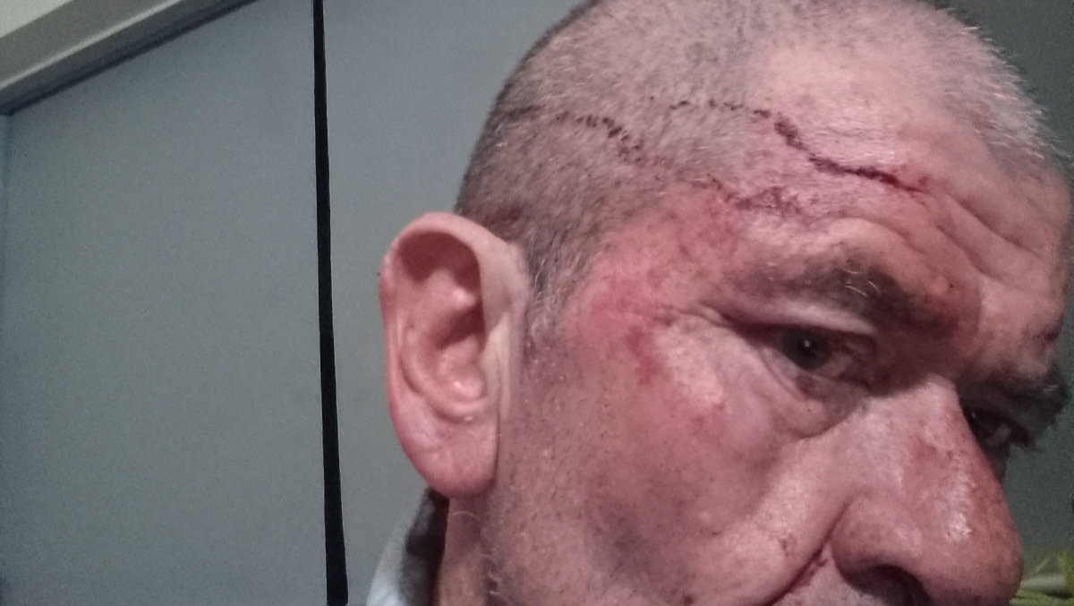 Help Unionist Survivor & Elder Shocking Sad Story