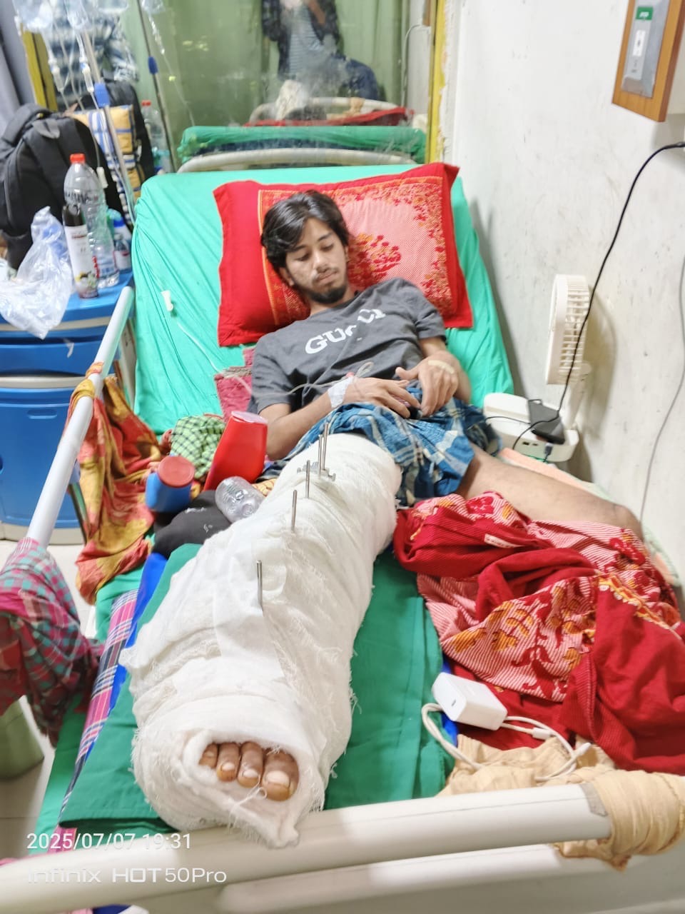 Save Maimul Islam's Leg After Tragic Accident campaign photo, 2 of 4