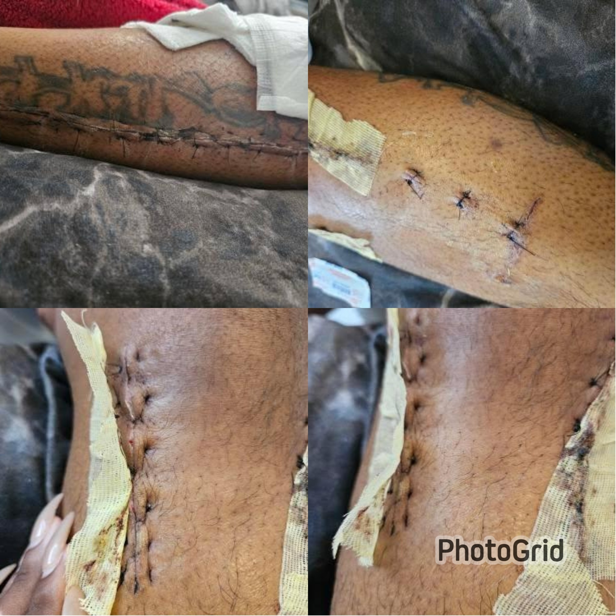 Support Des Through Knee Surgery Recovery campaign photo, 7 of 8