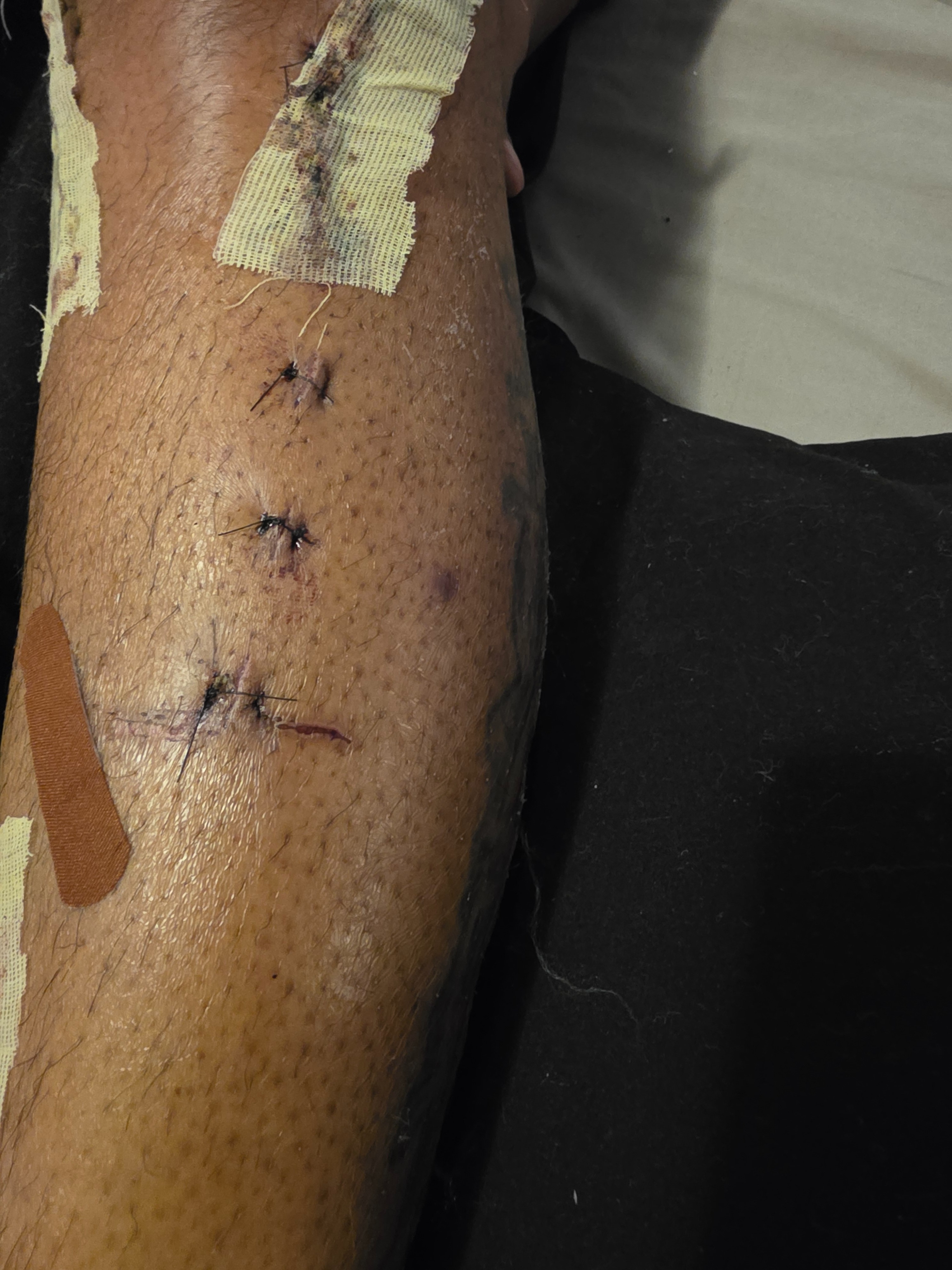 Support Des Through Knee Surgery Recovery campaign photo, 2 of 8