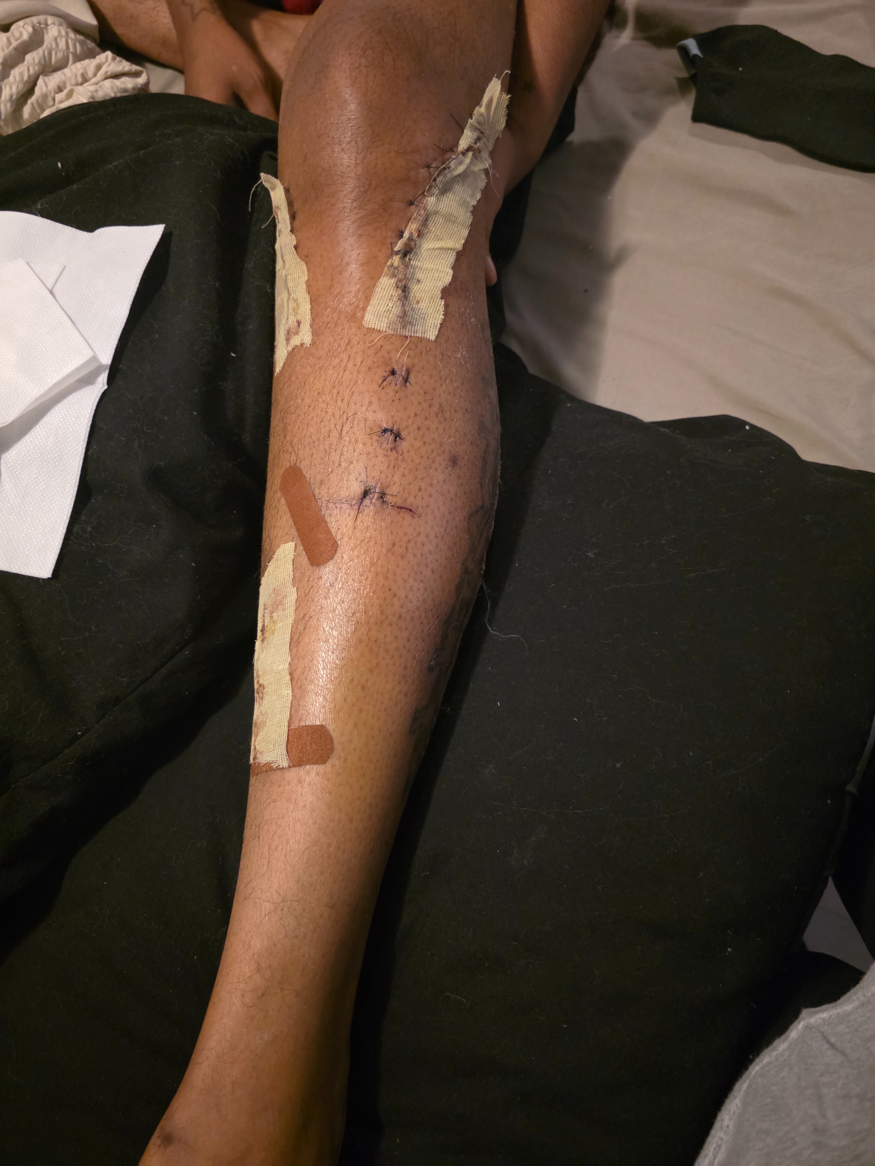 Support Des Through Knee Surgery Recovery campaign photo, 4 of 8