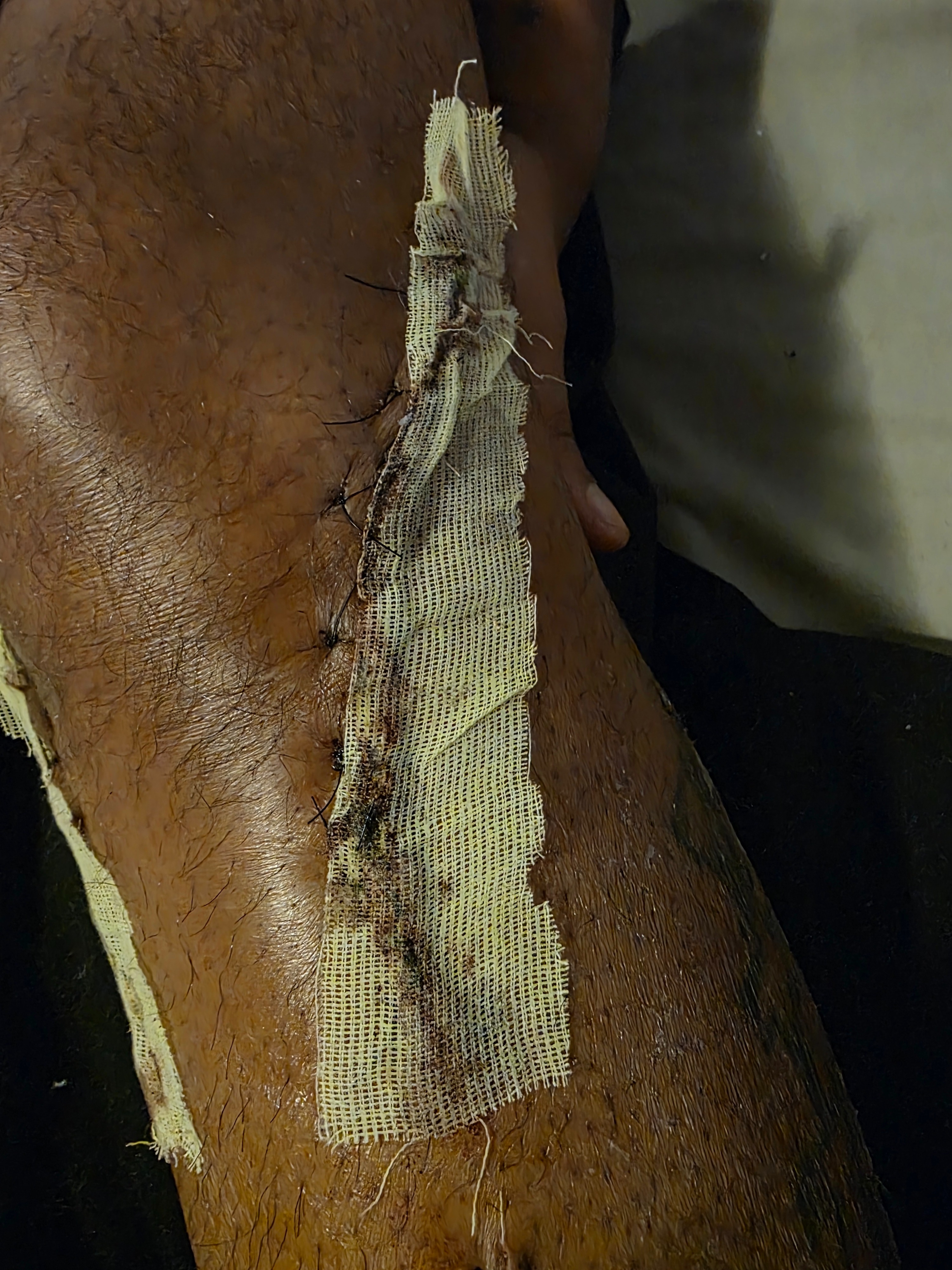 Support Des Through Knee Surgery Recovery campaign photo, 5 of 8