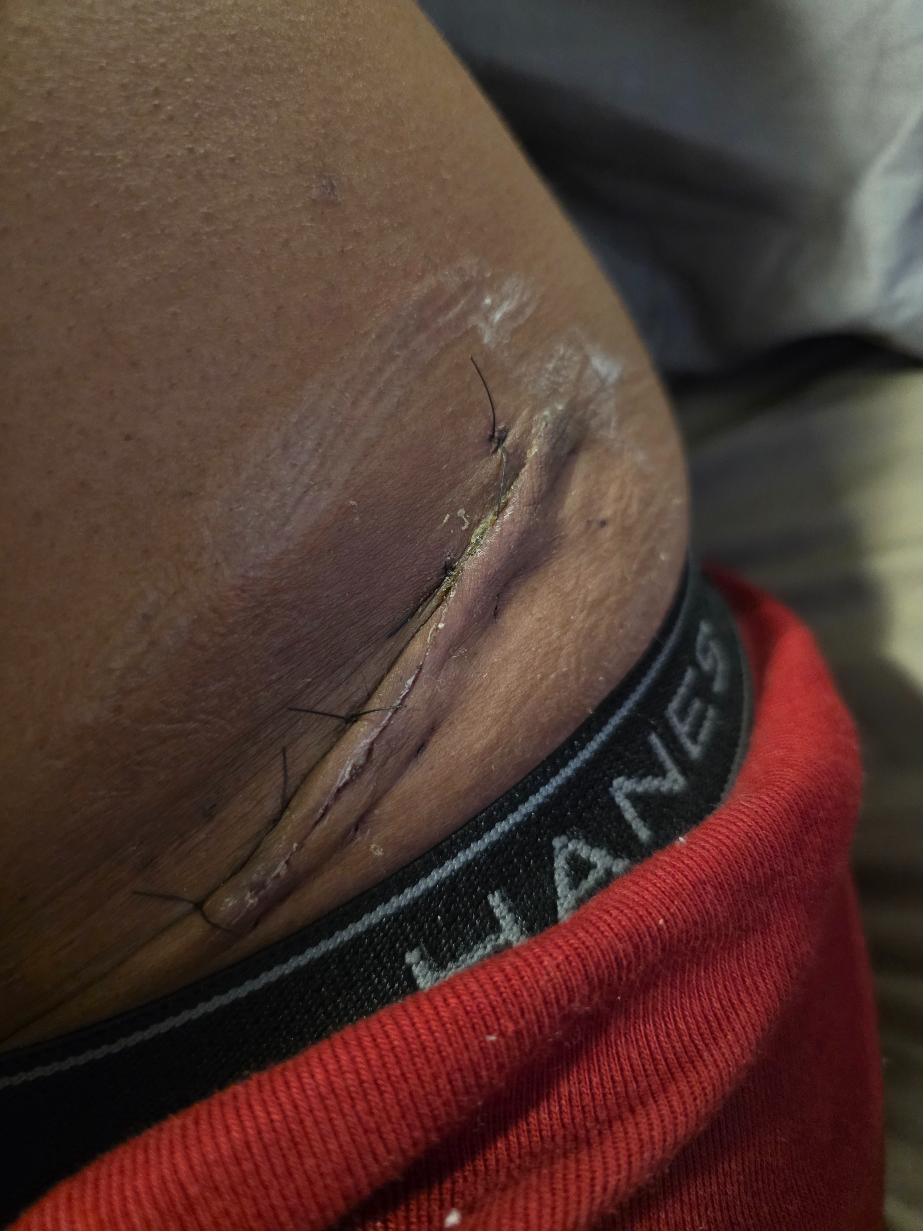 Support Des Through Knee Surgery Recovery campaign photo, 6 of 8