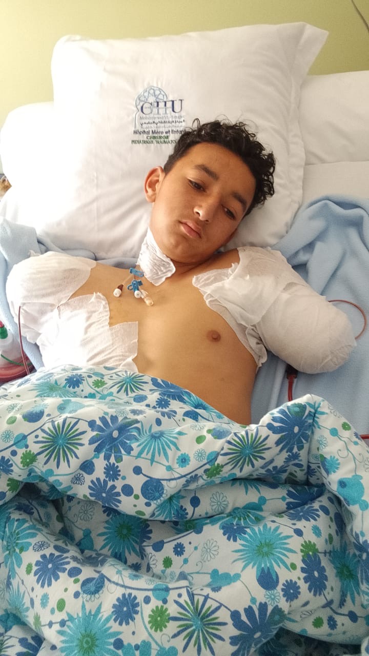 Help Samir zijn armen en toekomst teruggeven. campaign photo, 2 of 5