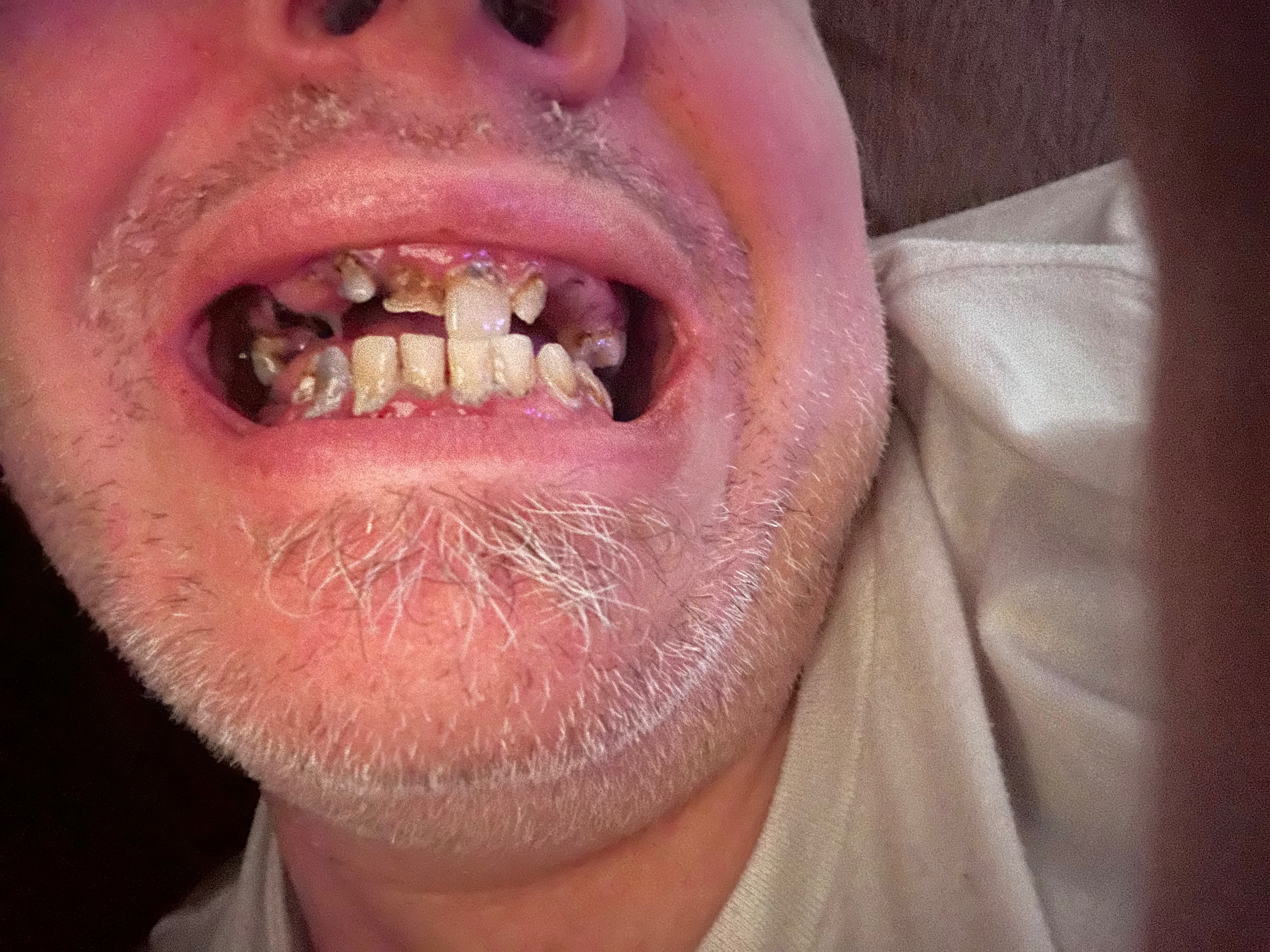Lex Needs Your Help for Vital Dental Care campaign photo, 2 of 5