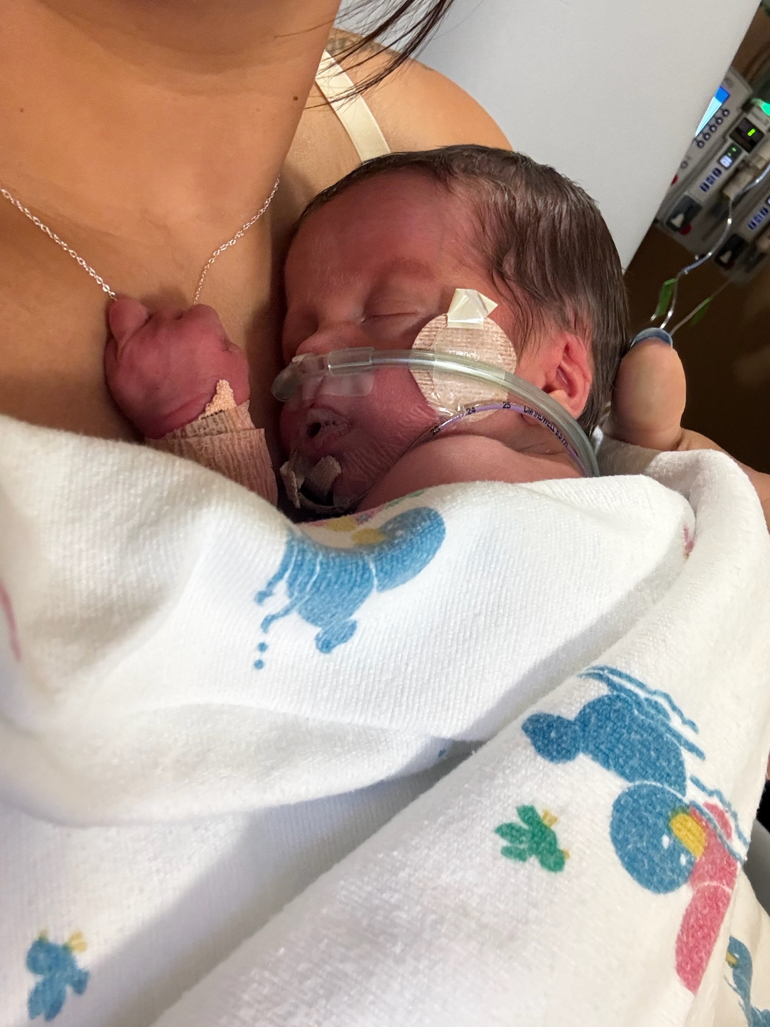 Help Support the Quinn Family During Callum’s NICU Journey campaign photo, 2 of 4
