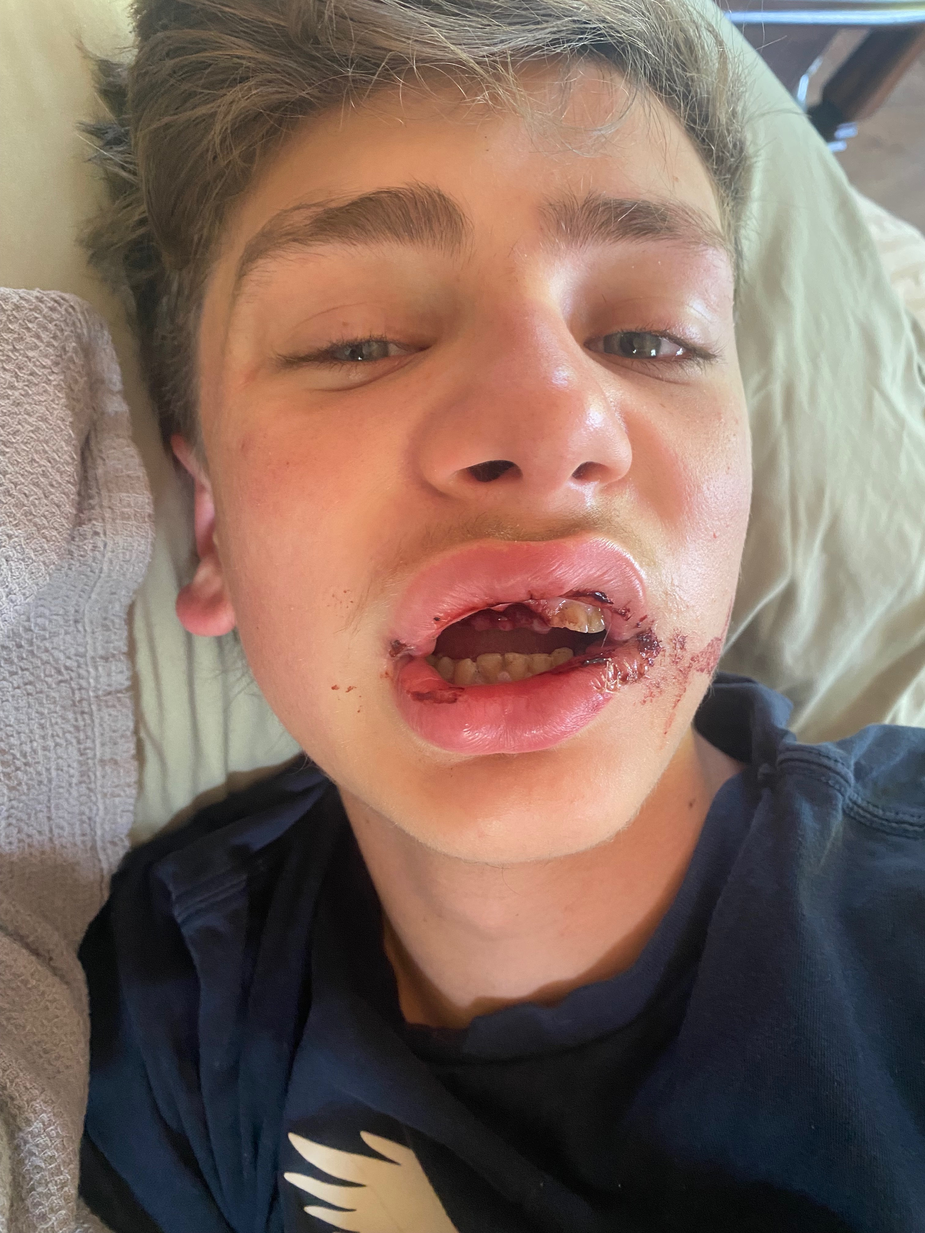 Atv accident campaign photo, 6 of 7