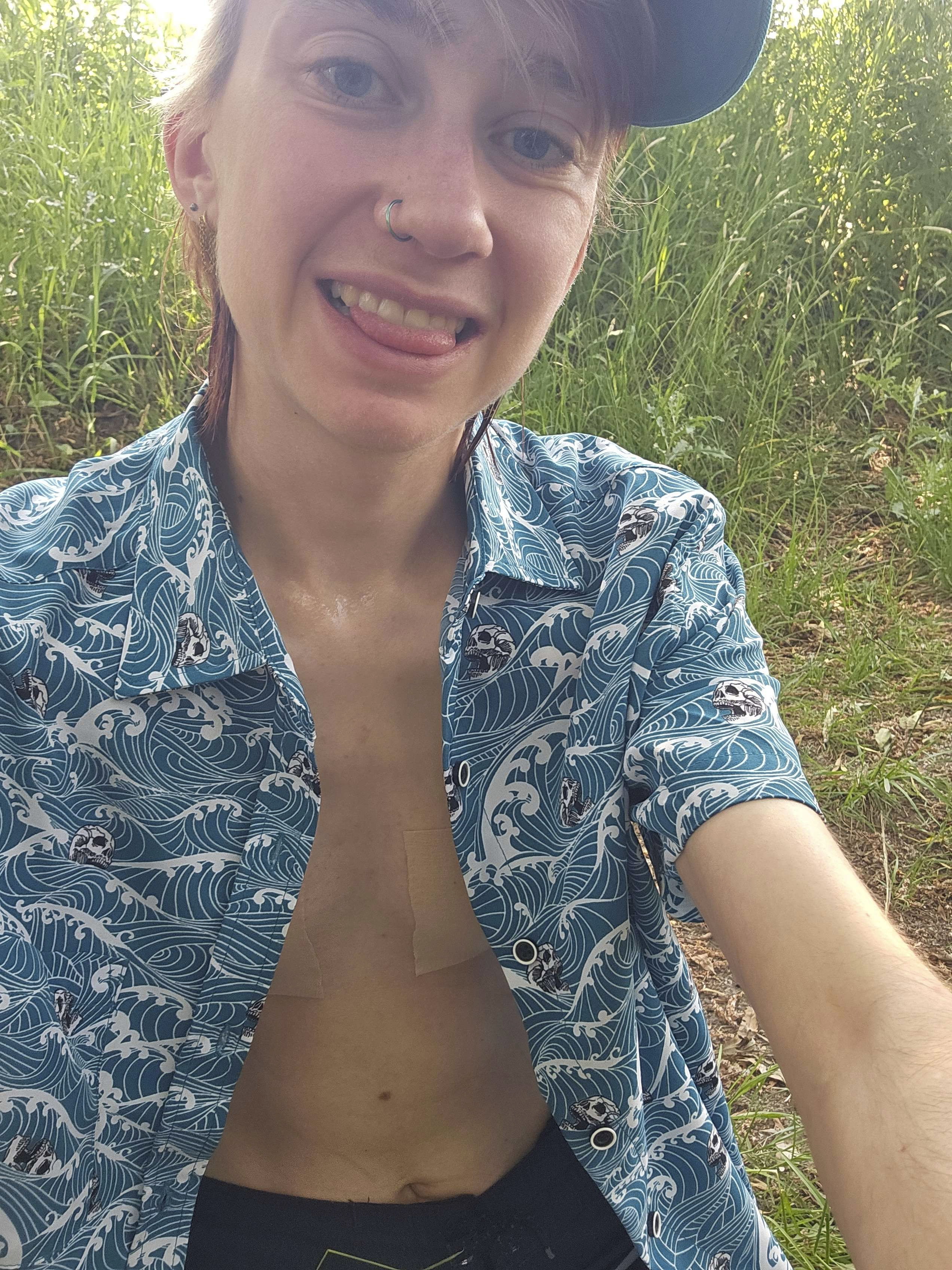 Help Vesper Achieve Their Top Surgery Dream campaign photo, 2 of 8