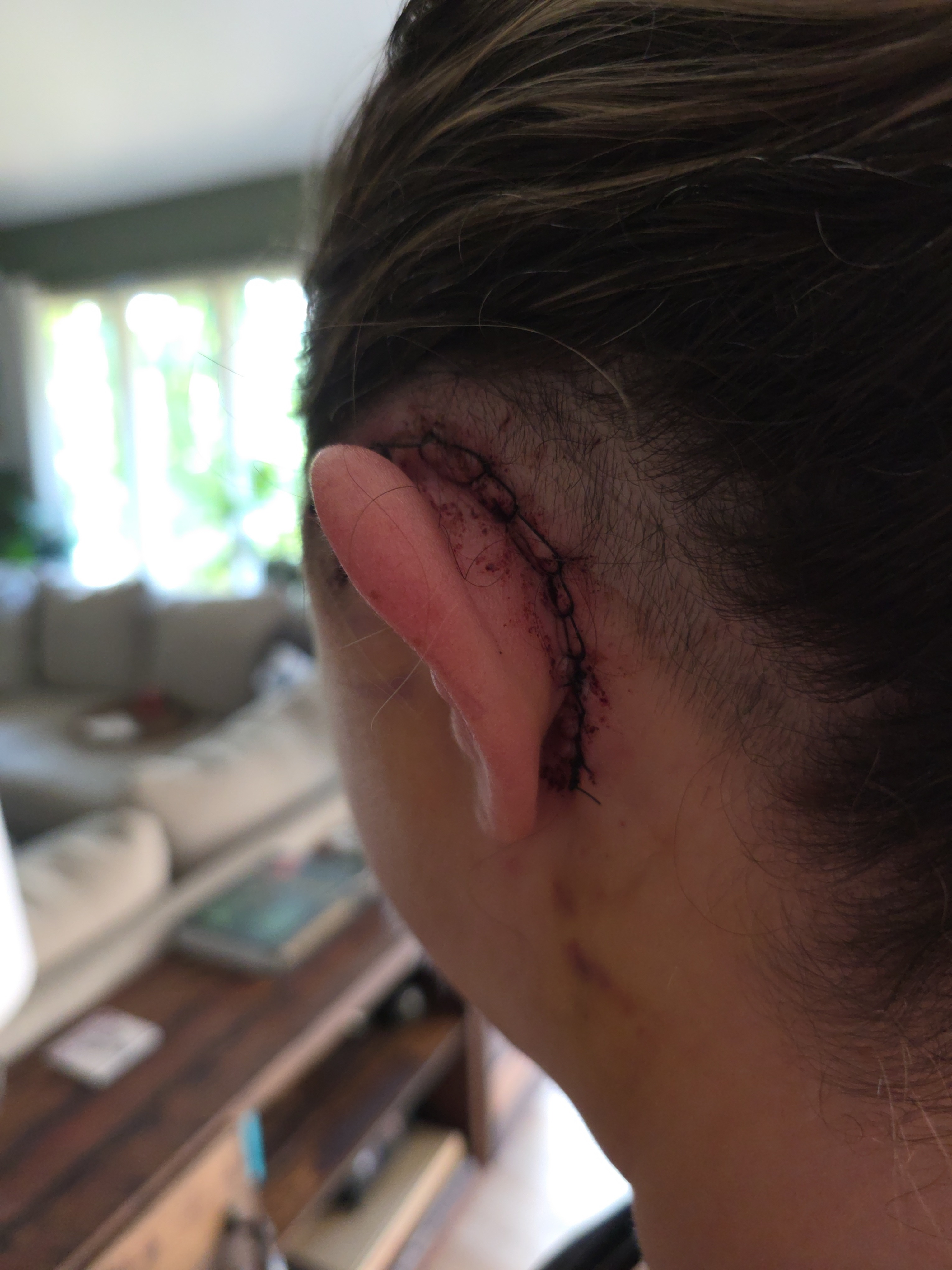 Support Kimberly's Brain Surgery Journey campaign photo, 4 of 8
