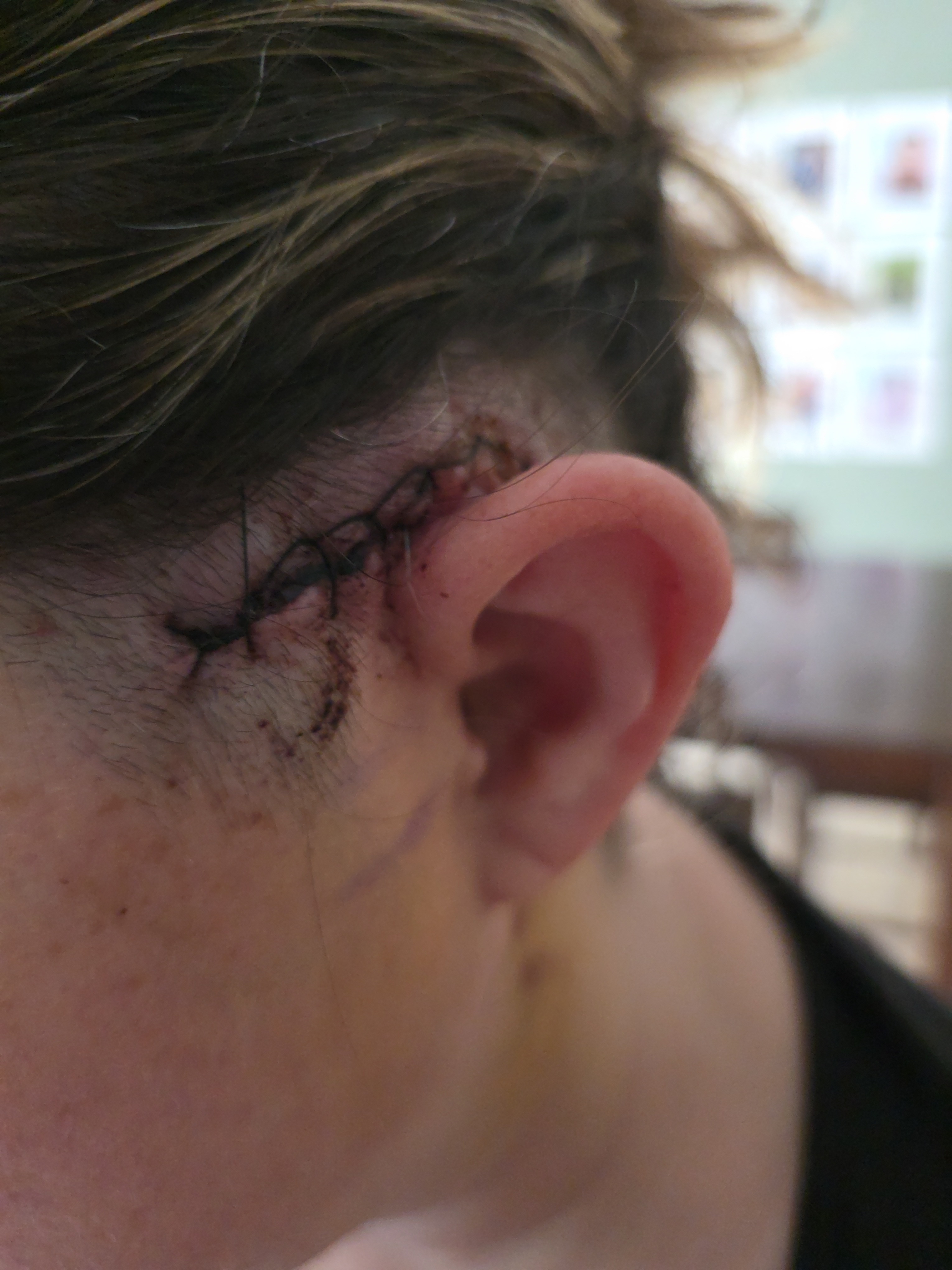 Support Kimberly's Brain Surgery Journey campaign photo, 5 of 8