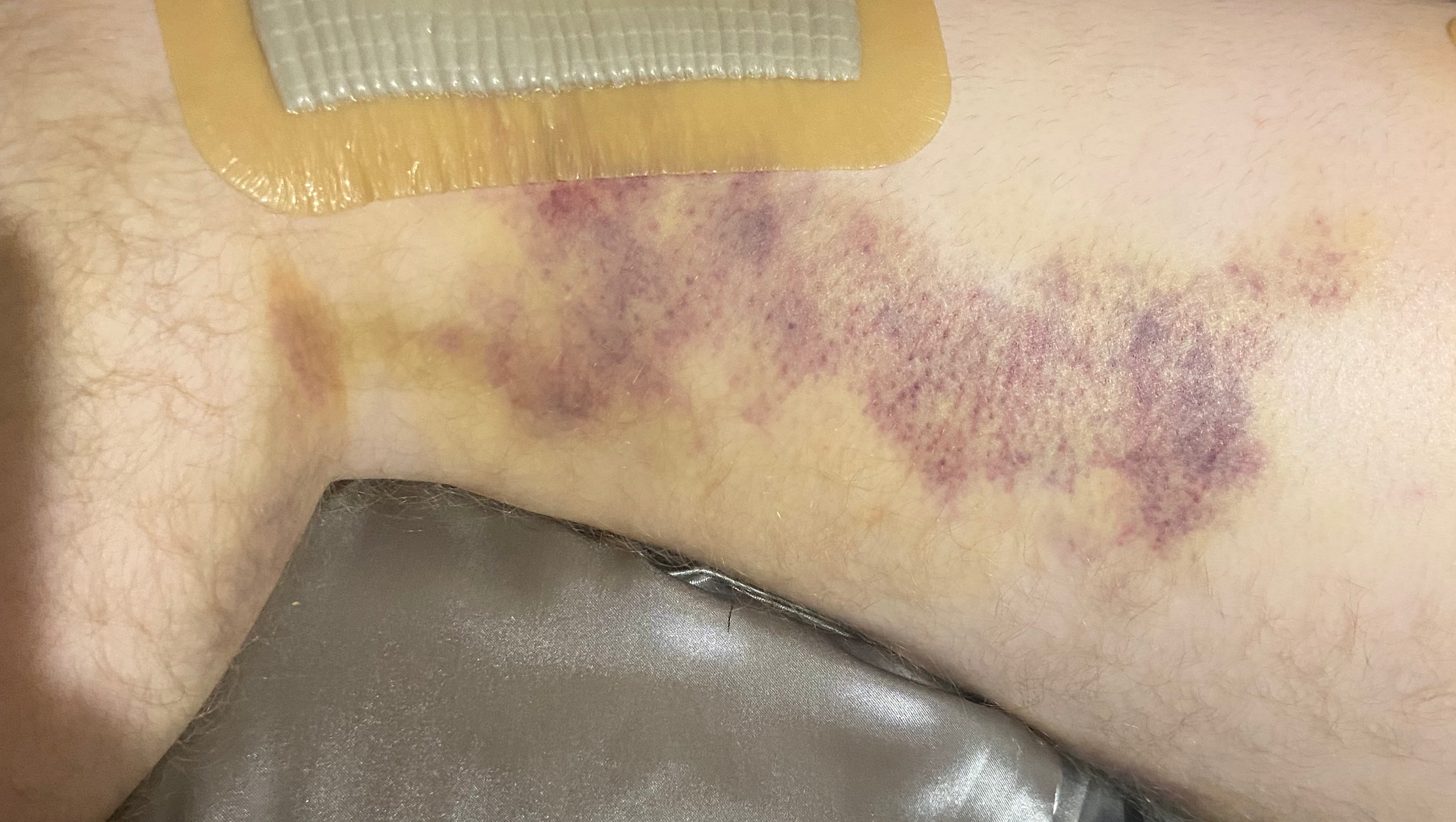 Assist Michael and his family in his recovery. pinned link photo