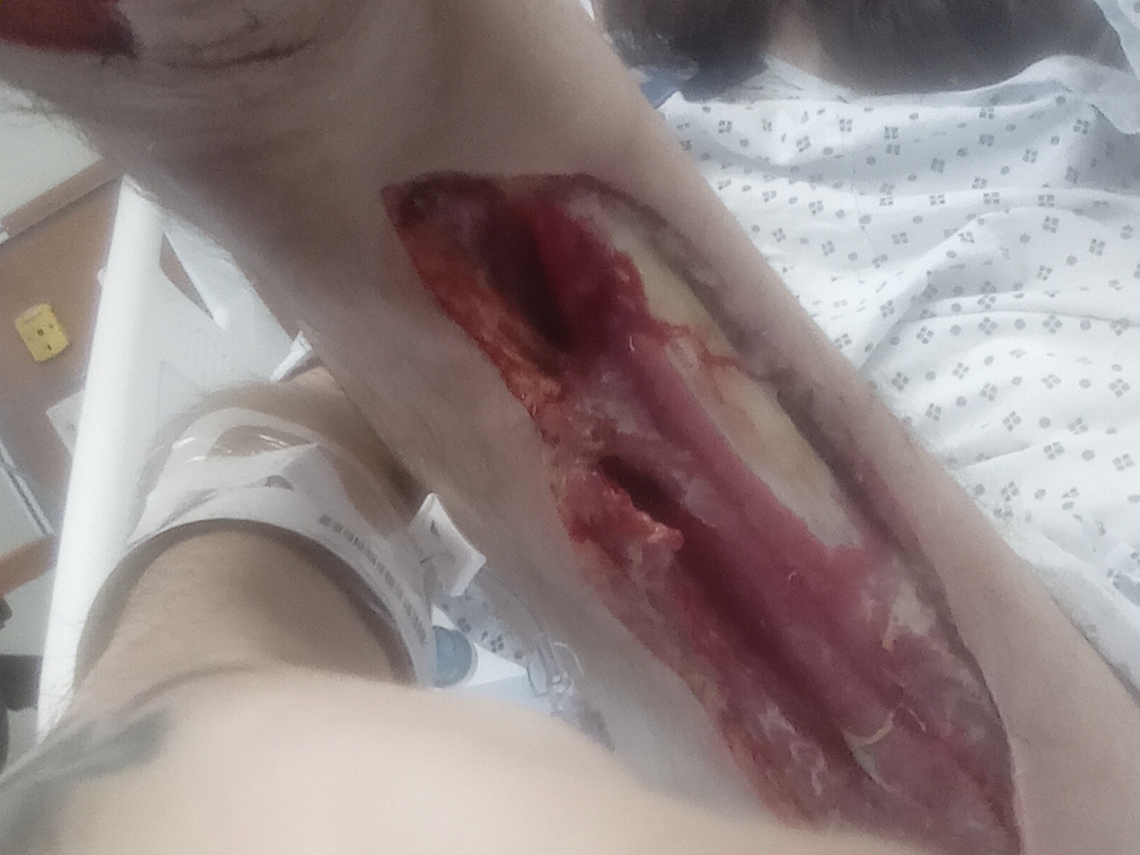 Help Dax Battle Severe Leg Infection. Anything helps campaign photo, 7 of 8