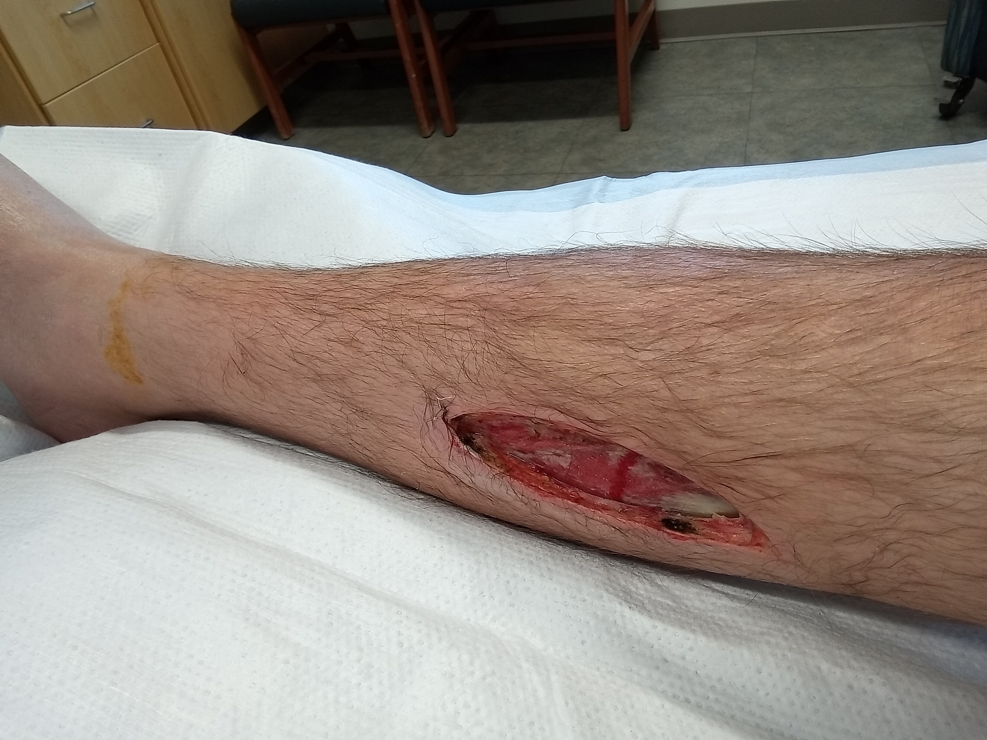 Help Dax Battle Severe Leg Infection. Anything helps campaign photo, 2 of 8