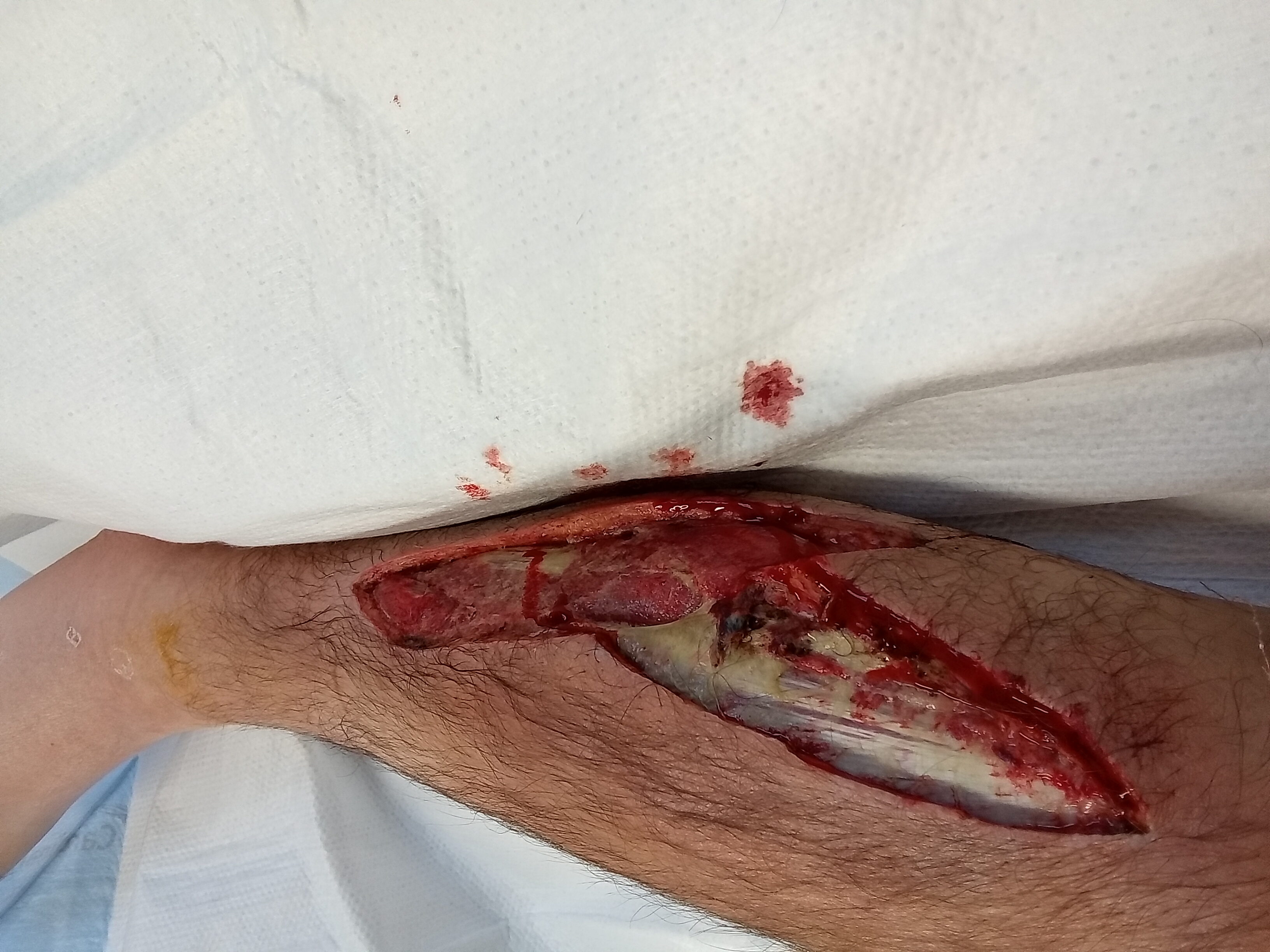 Help Dax Battle Severe Leg Infection. Anything helps campaign photo, 4 of 8