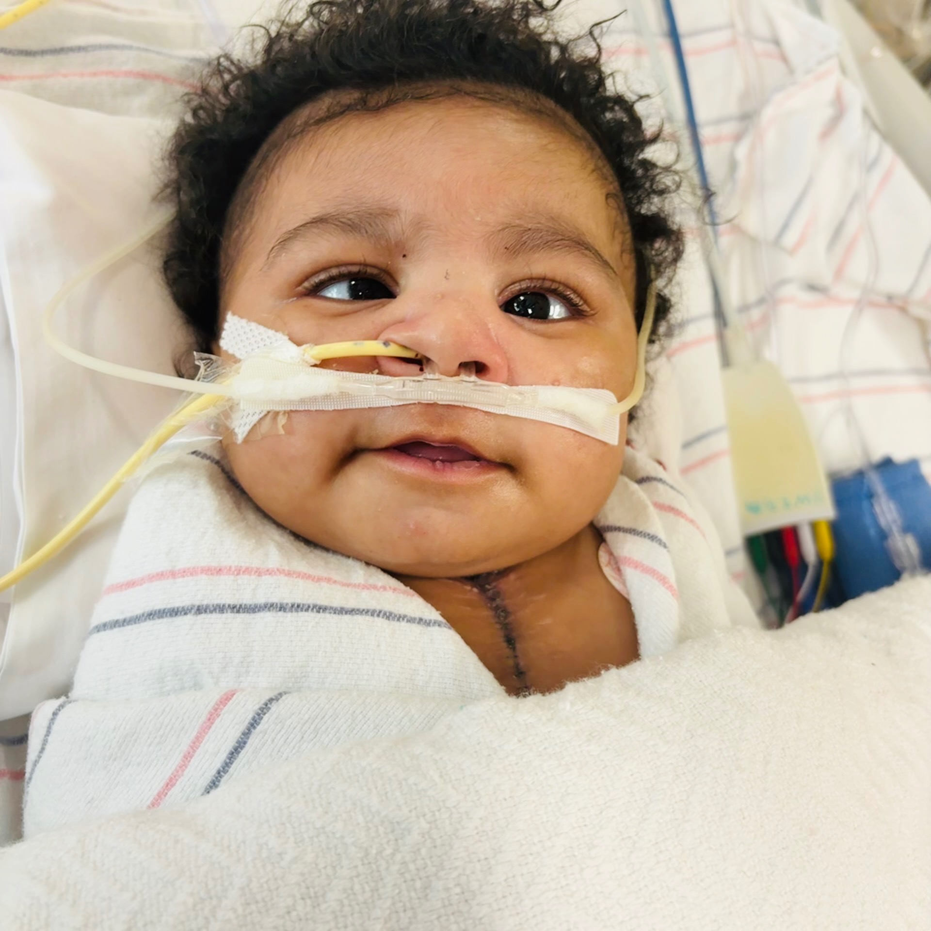 Support Tamarion Paul's Heart Surgery Journey campaign photo, 2 of 8