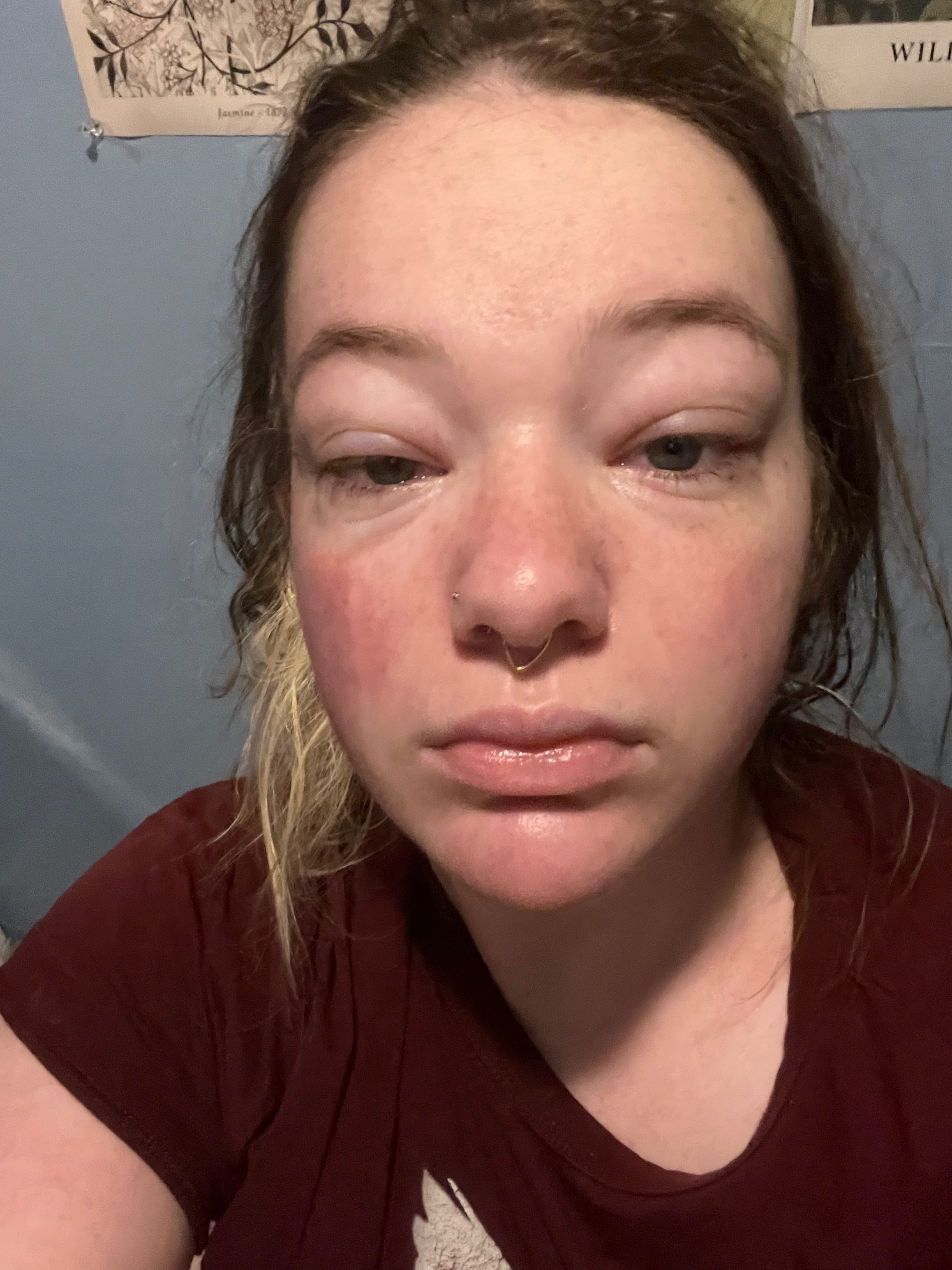 Help Lydia Get to Mayo Clinic — and Fight Lupus Back campaign photo, 2 of 7
