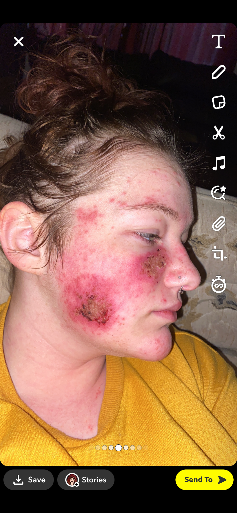 Help Lydia Get to Mayo Clinic — and Fight Lupus Back campaign photo, 5 of 7