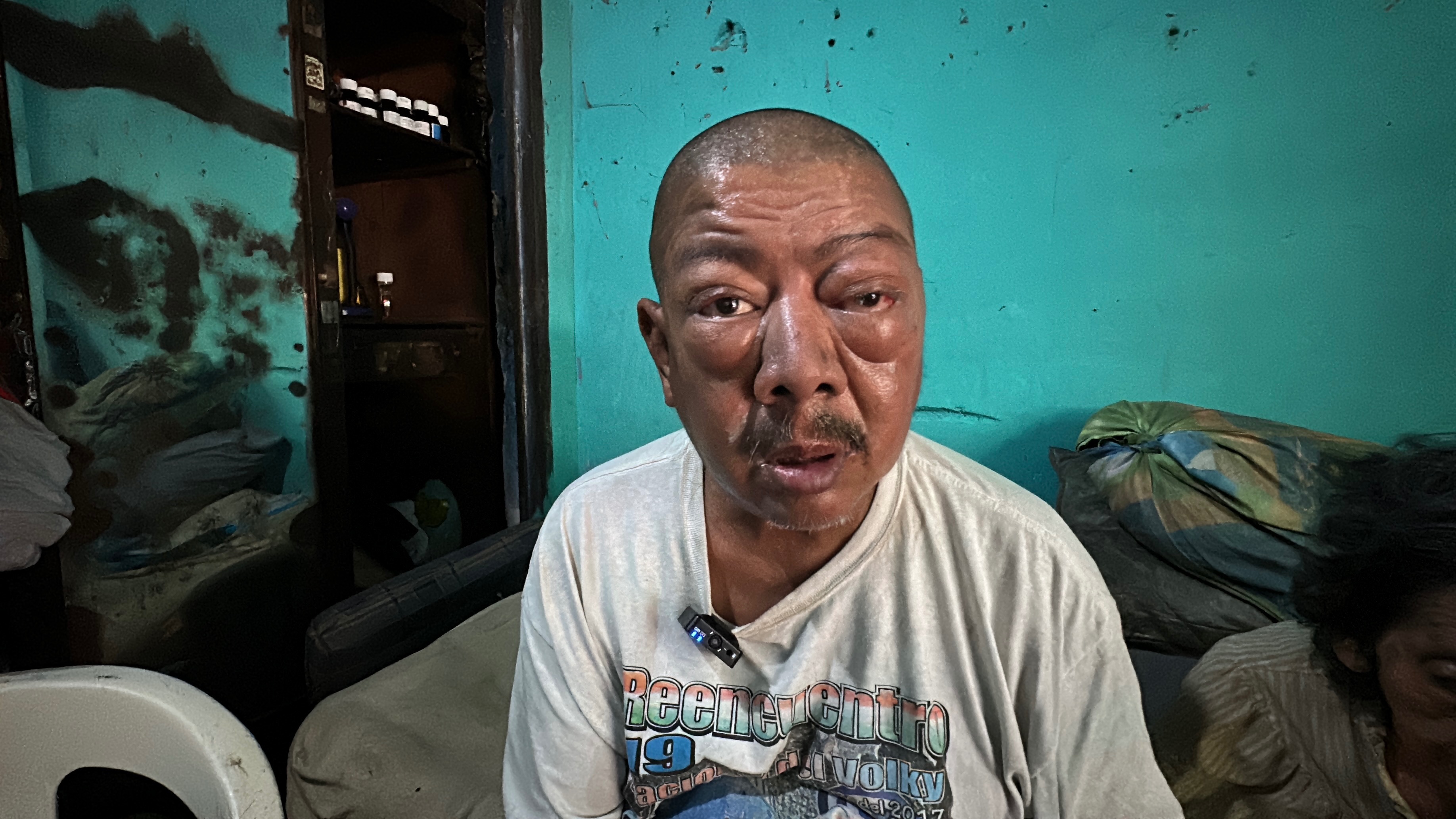 Ayudemos a Don Carlos a recuperar la vista campaign photo, 2 of 8
