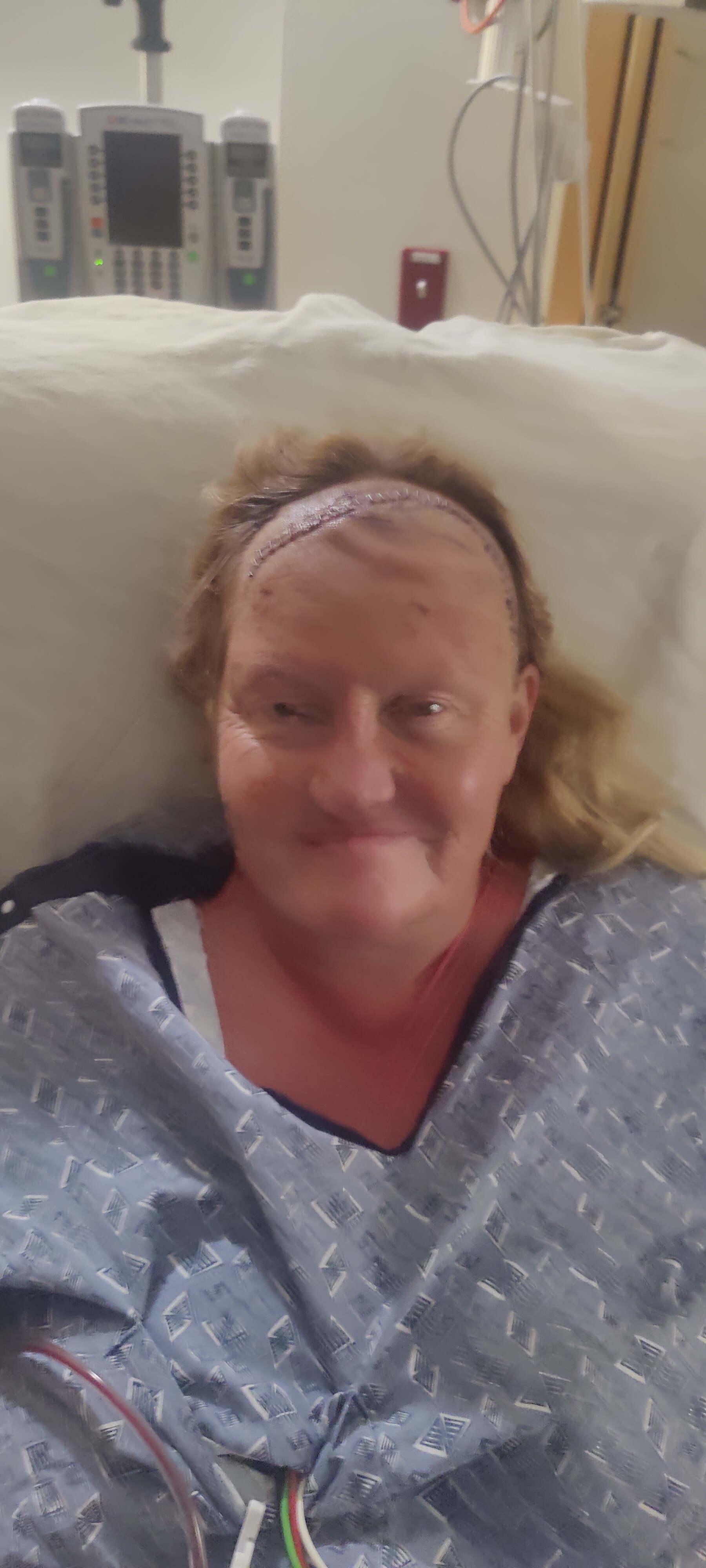Support Joanna's Journey: Brain Tumor Recovery campaign photo, 2 of 6