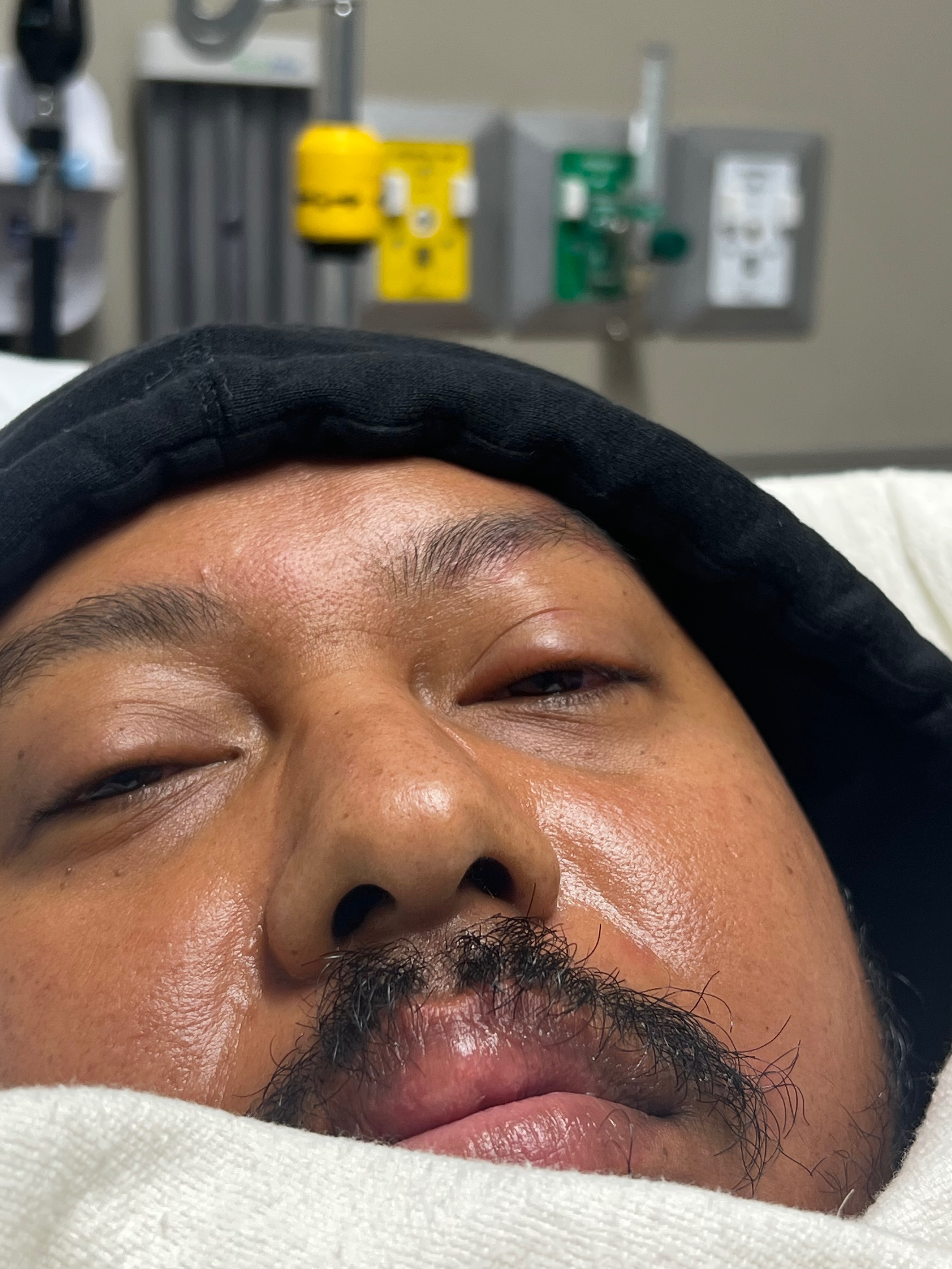 Help Me Recover from Ramsay Hunt Syndrome & Meningitis  campaign photo, 4 of 6