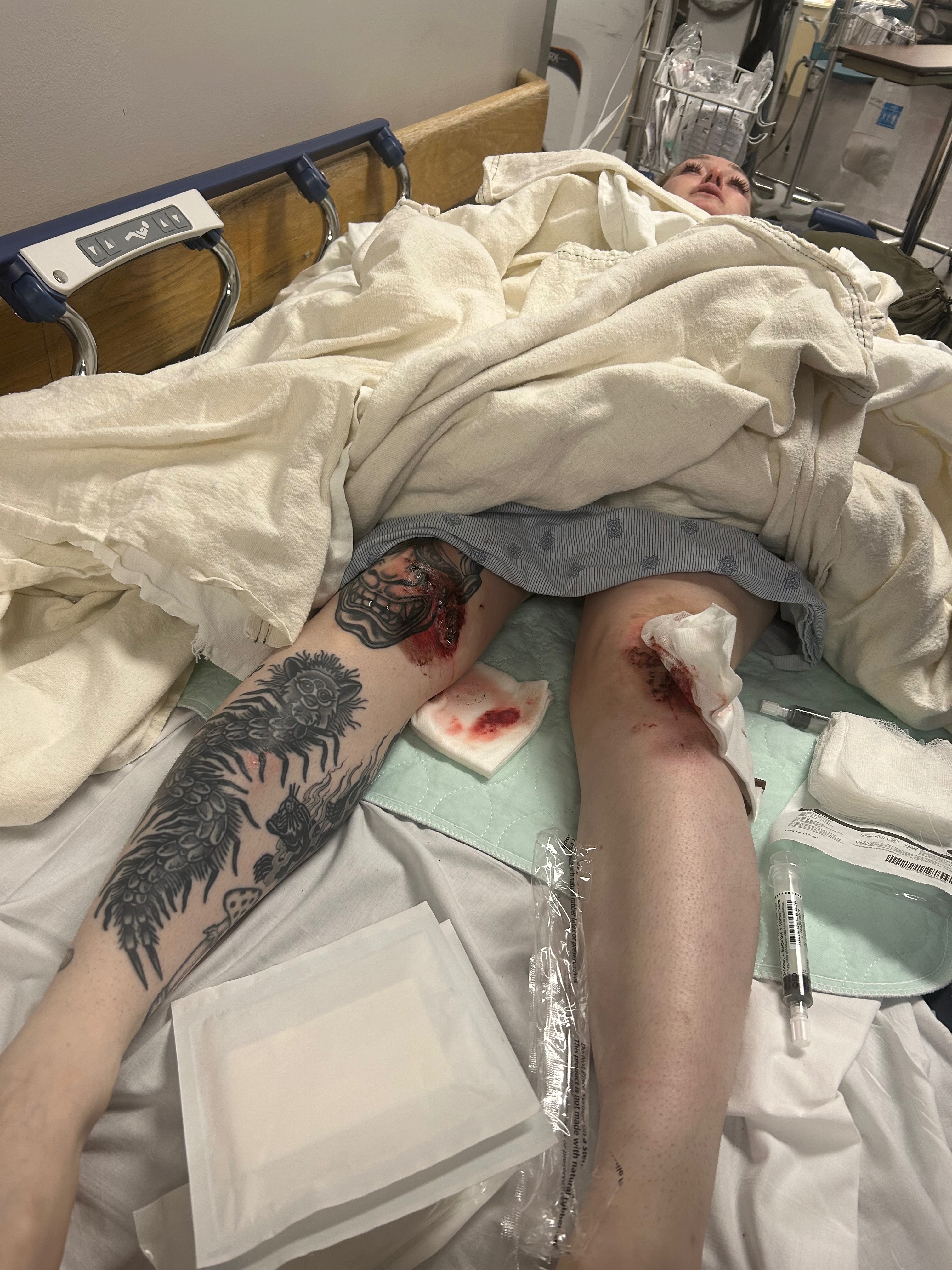 Support Haley’s road to recovery after her crash campaign photo, 6 of 7