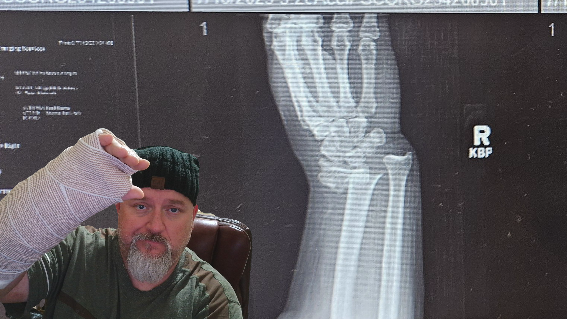 Facing Surgery and 4 Months Without Work campaign photo, 2 of 4