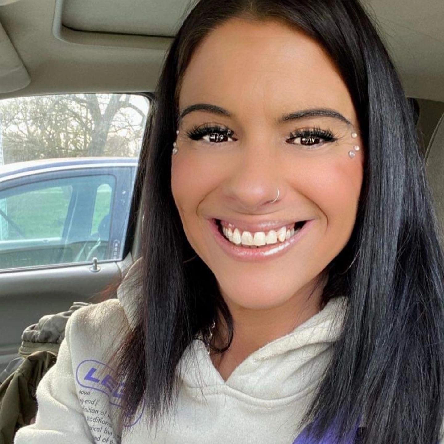 Support Jessie's Battle with Lupus and Cancer campaign photo, 4 of 5