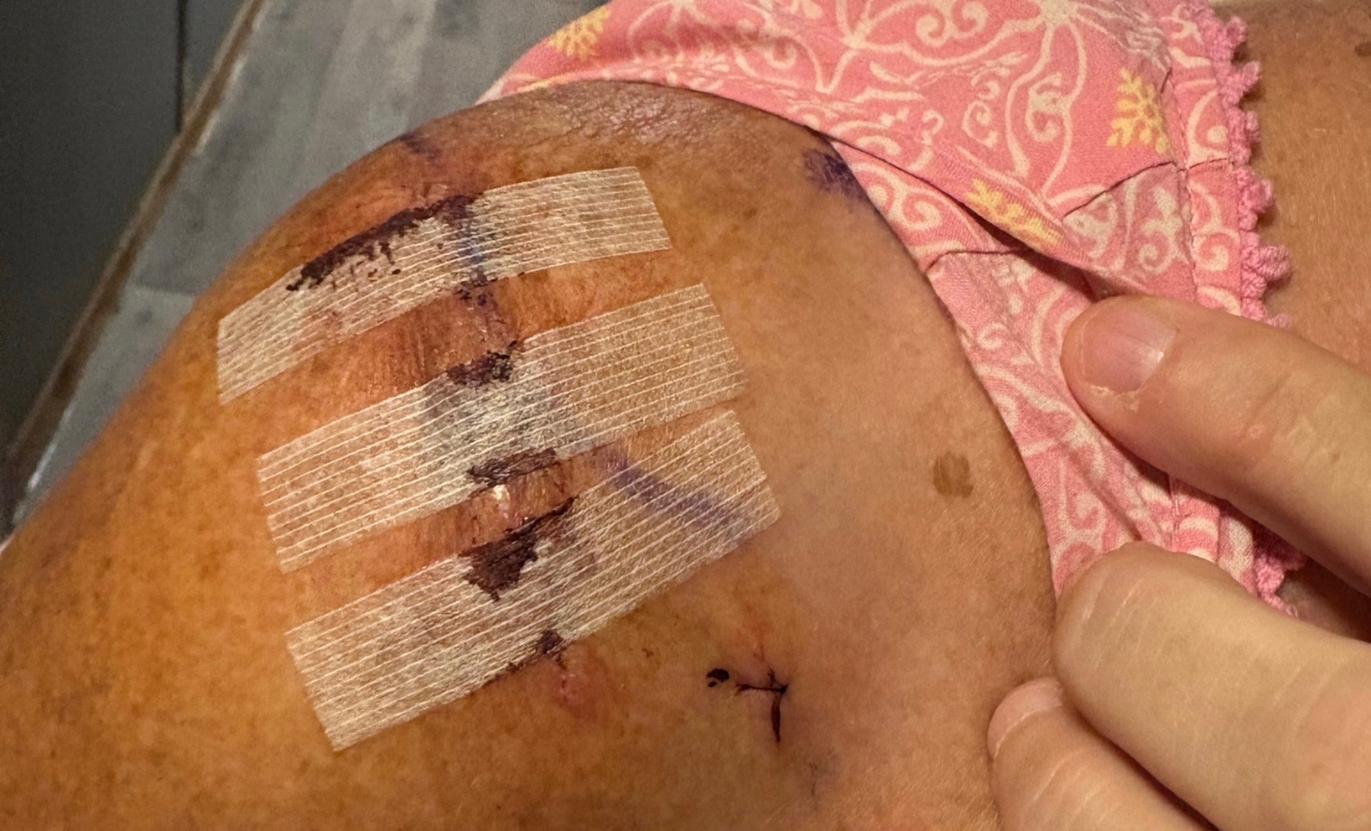 Kimberly Needs Your Help After Accident campaign photo, 2 of 4