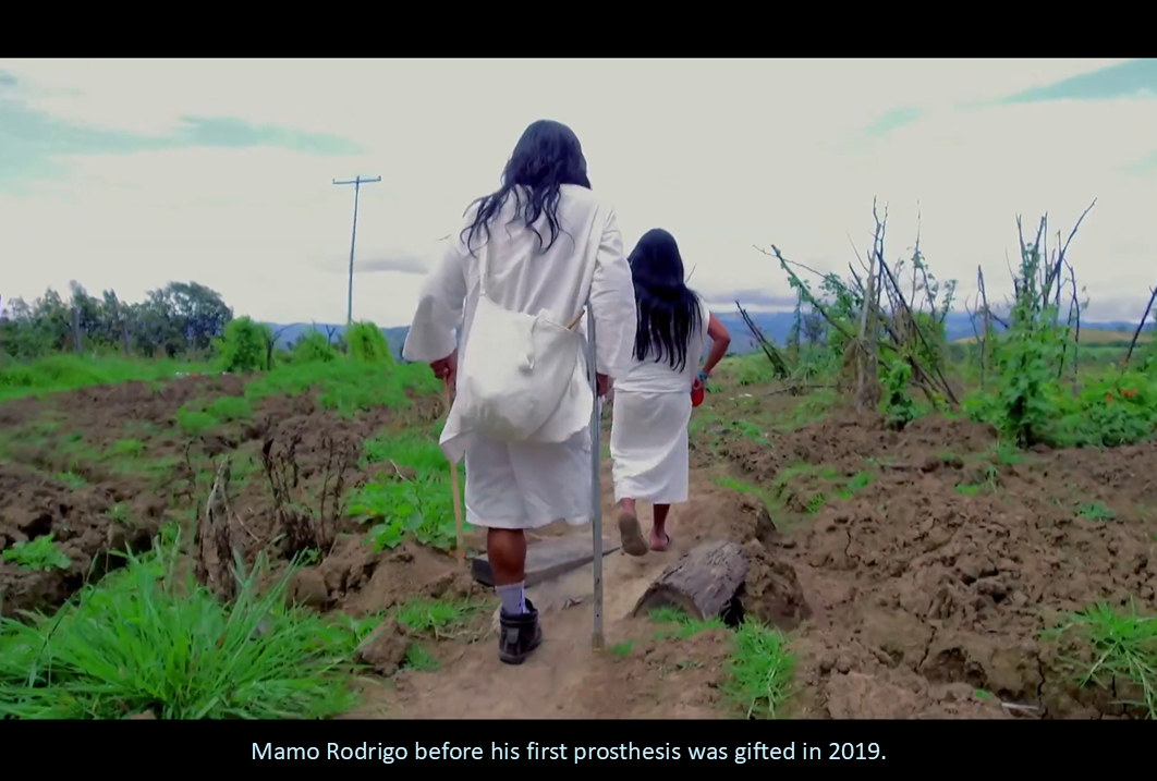 URGENT - Repair Mamo Rodrigo's Leg Prosthesis campaign photo, 4 of 7