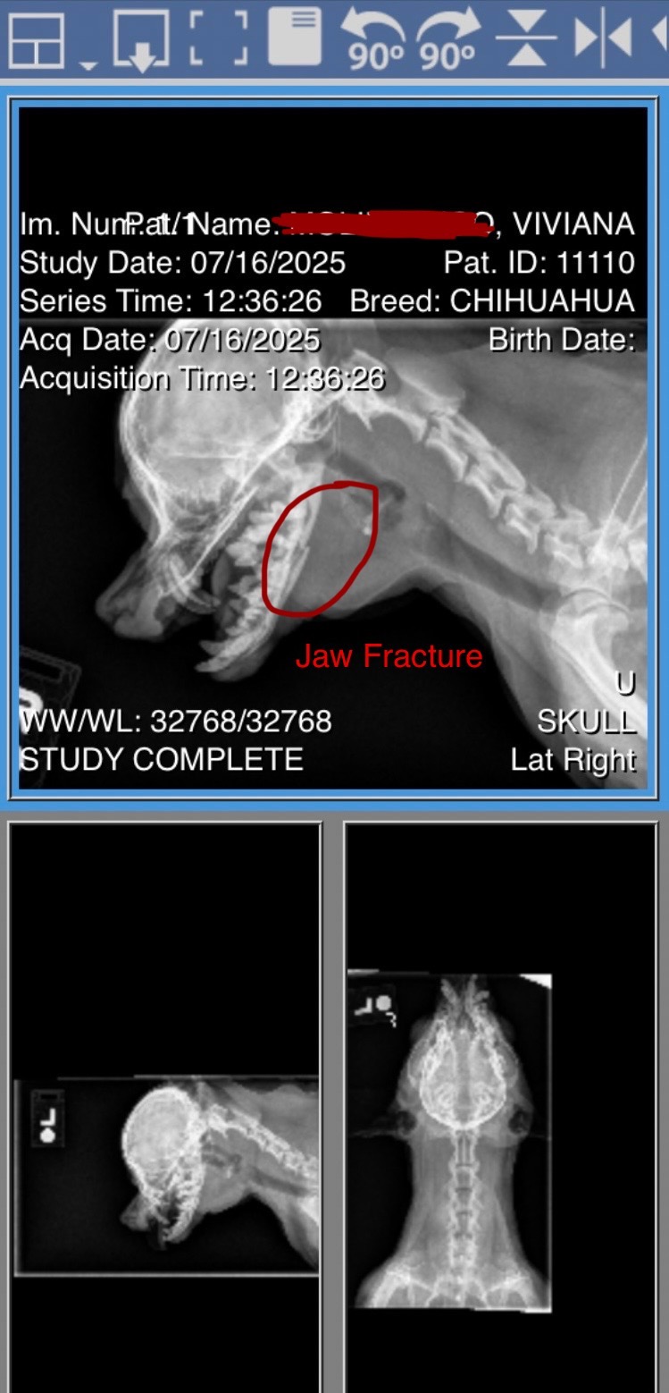Save Vee: Urgent Jaw Surgery Needed campaign photo, 4 of 6