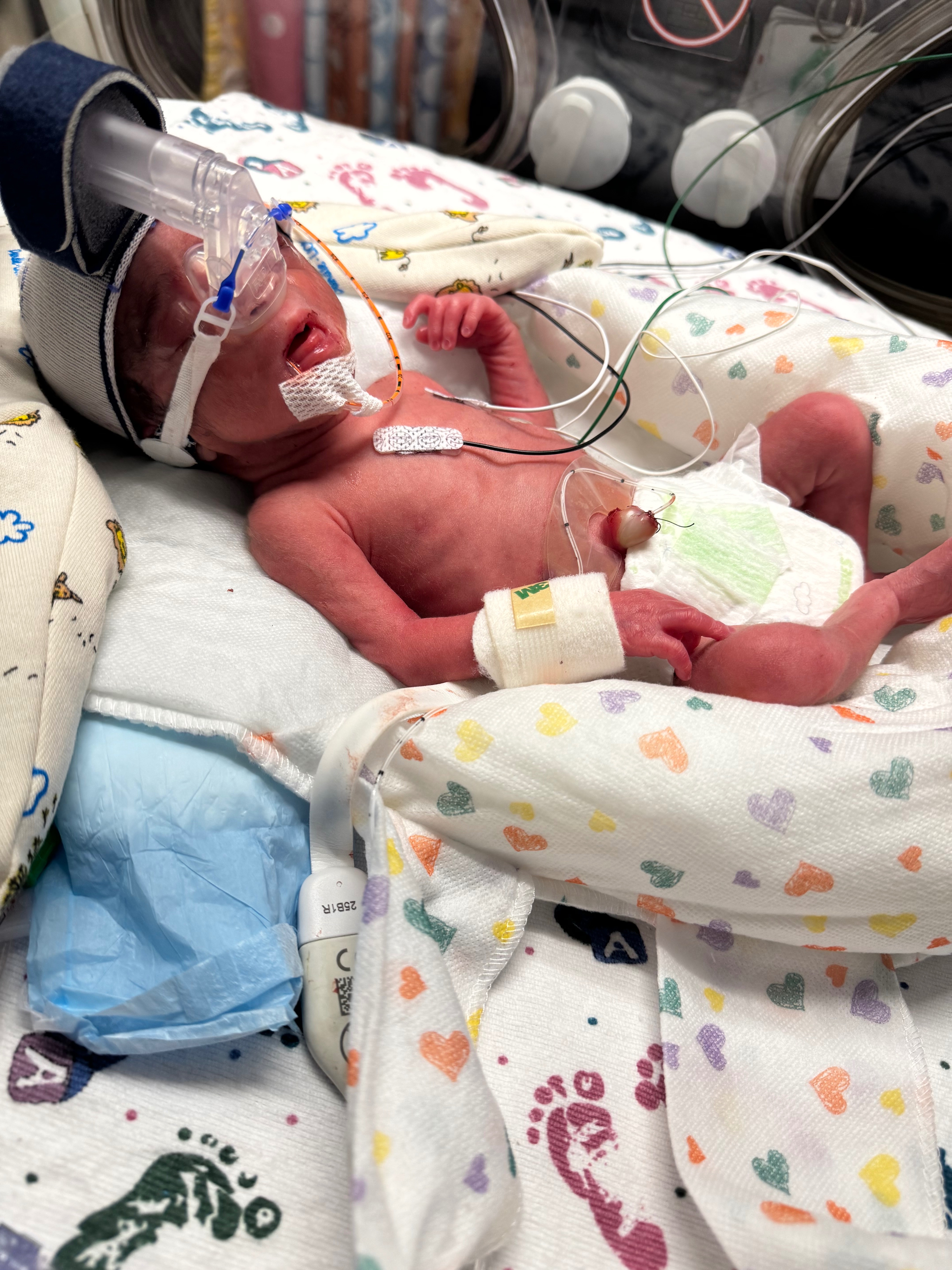 Support Krista and Her NICU Warrior Baby campaign photo, 2 of 4
