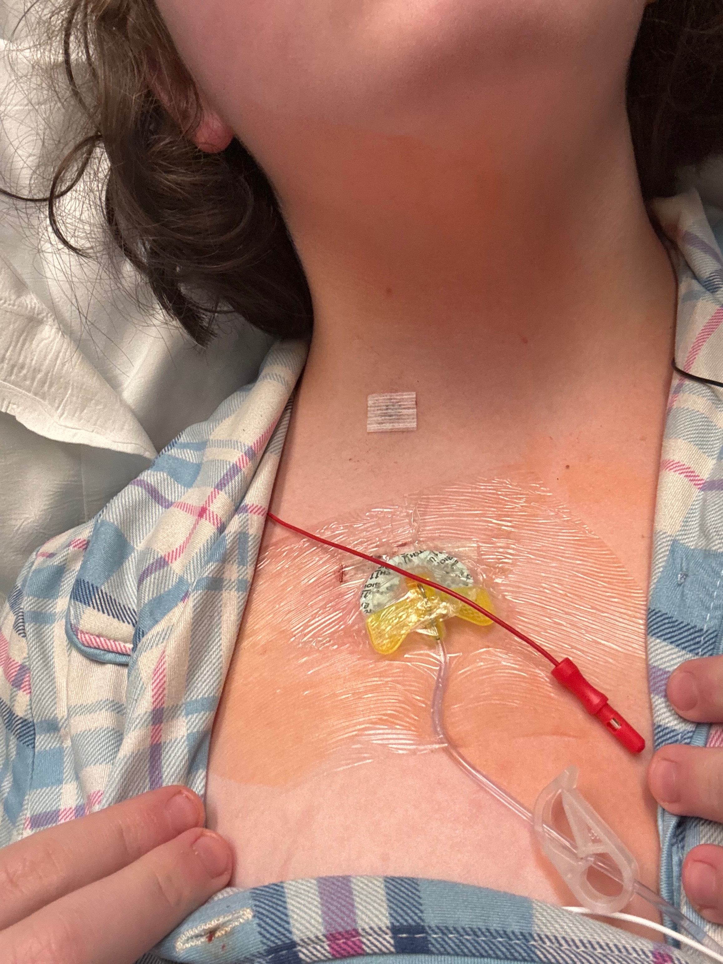 Donate to Kalli's Journey to Beat Cancer campaign photo, 4 of 8