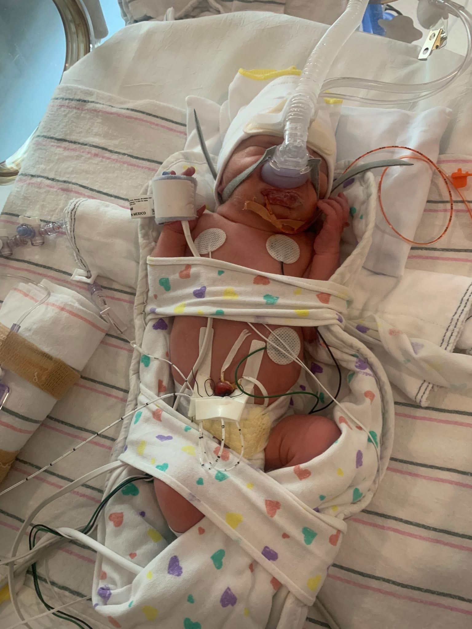 Support The Thornton Family: Baby Casey's Heart Journey campaign photo, 2 of 8