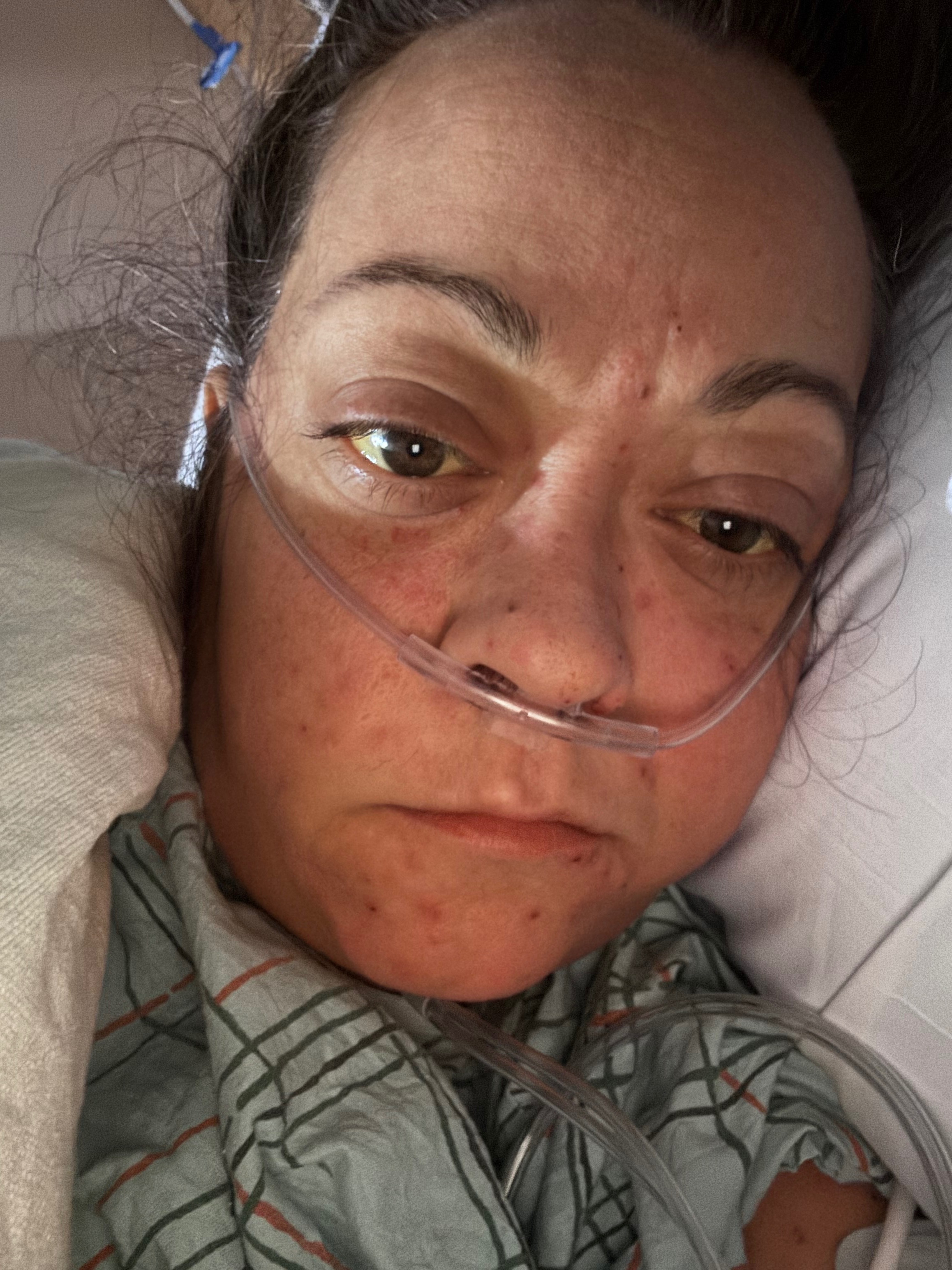 Donate to Lynne Inderwies' Transplant Journey campaign photo, 2 of 8