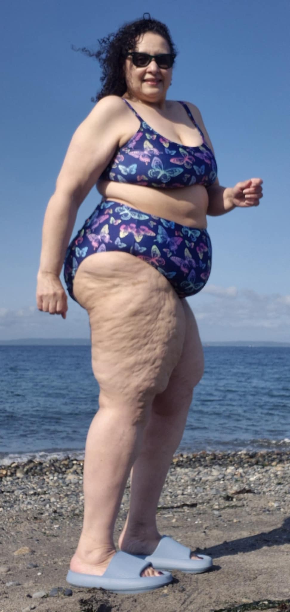Help Linda Reclaim Her Health and Confidence campaign photo, 2 of 8