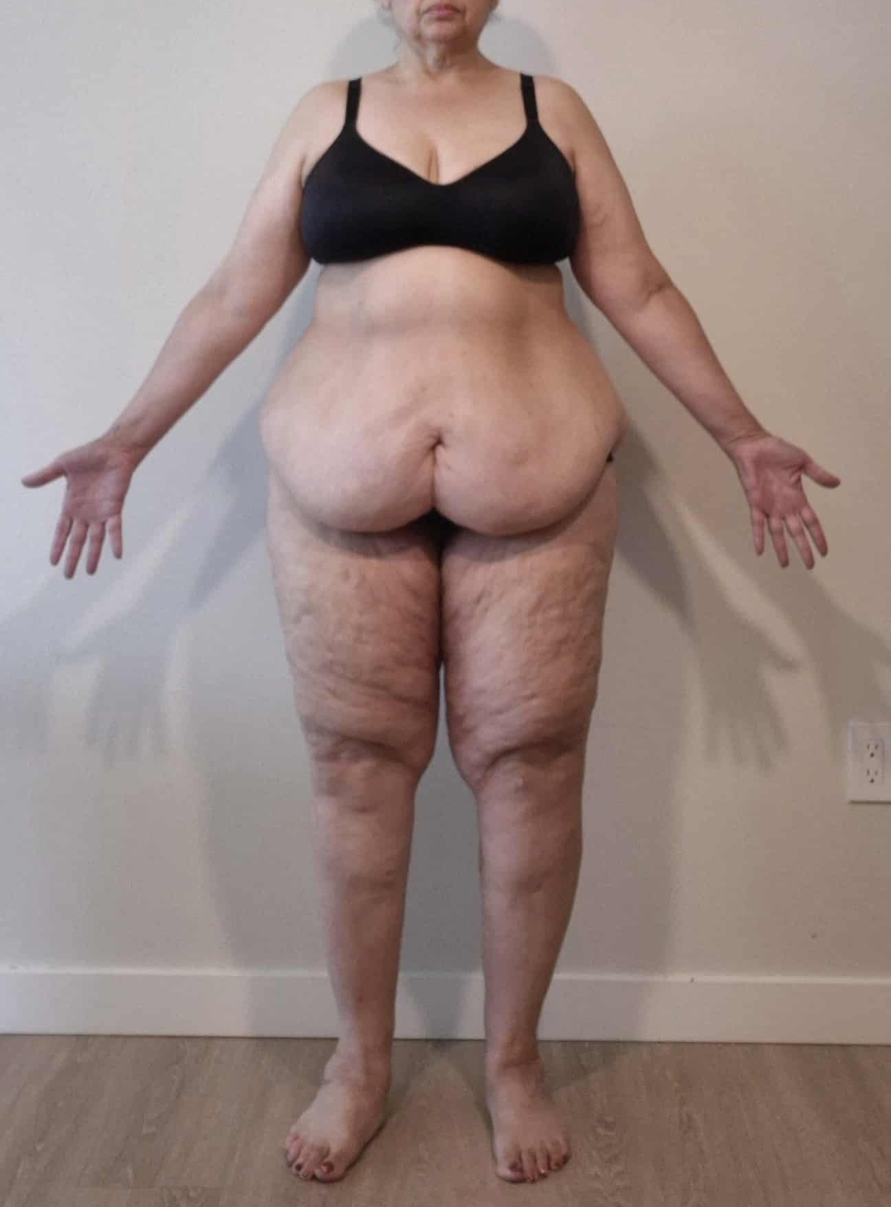 Help Linda Reclaim Her Health and Confidence campaign photo, 6 of 8