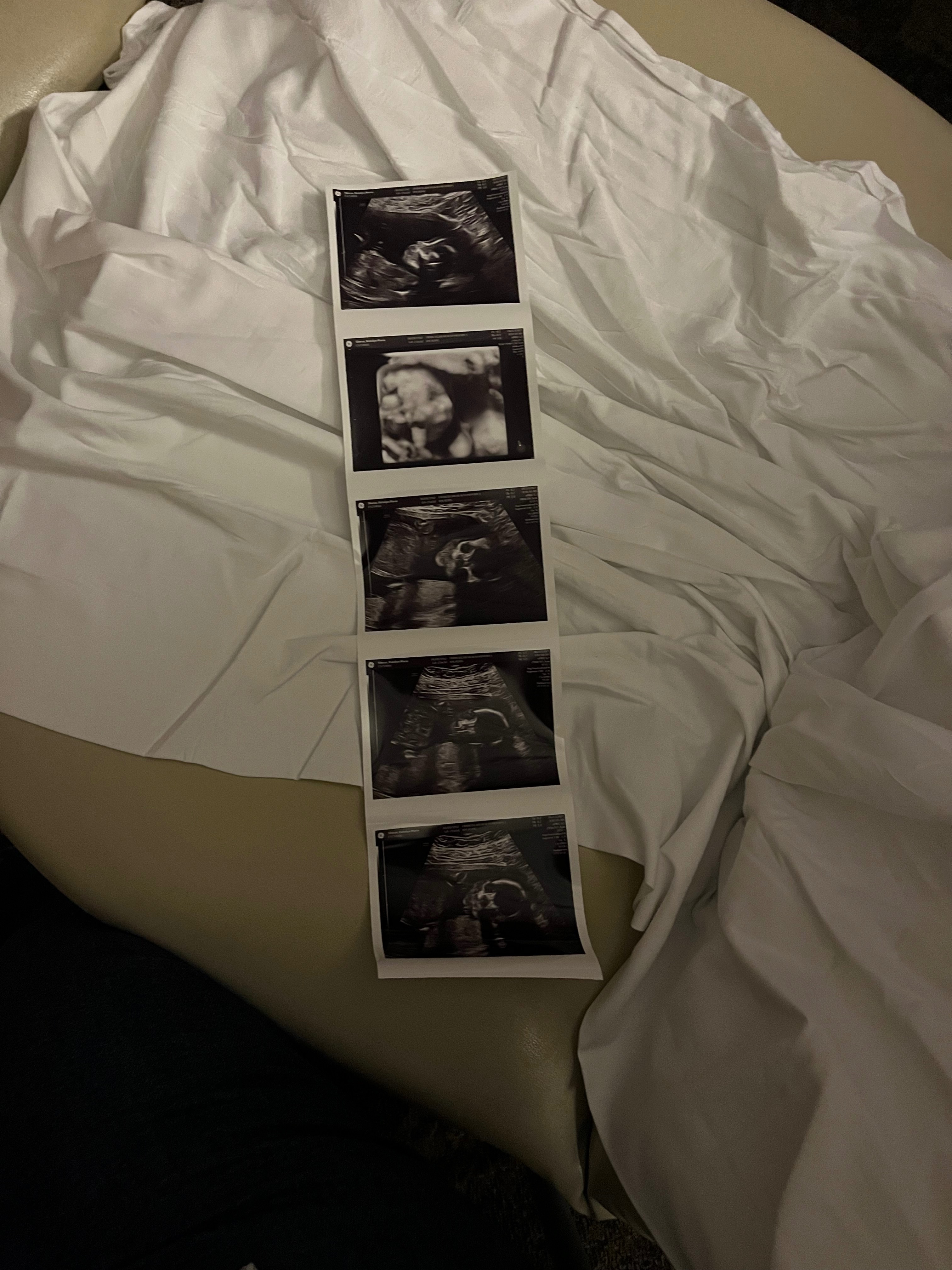 Help Me Take Paternity Leave! campaign photo, 2 of 4