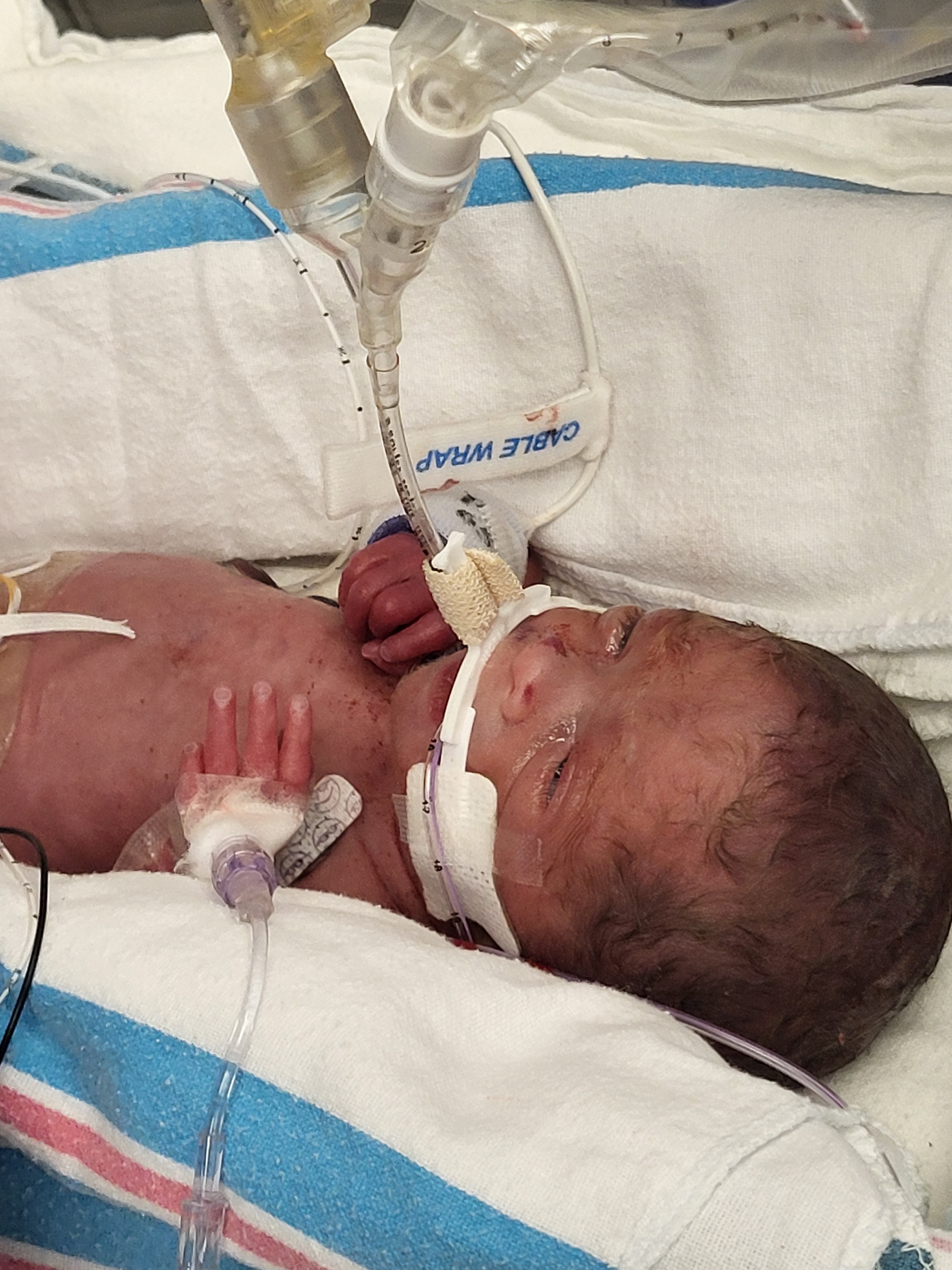 Hope Starts Here: Support Baby Rory’s Journey campaign photo, 2 of 7