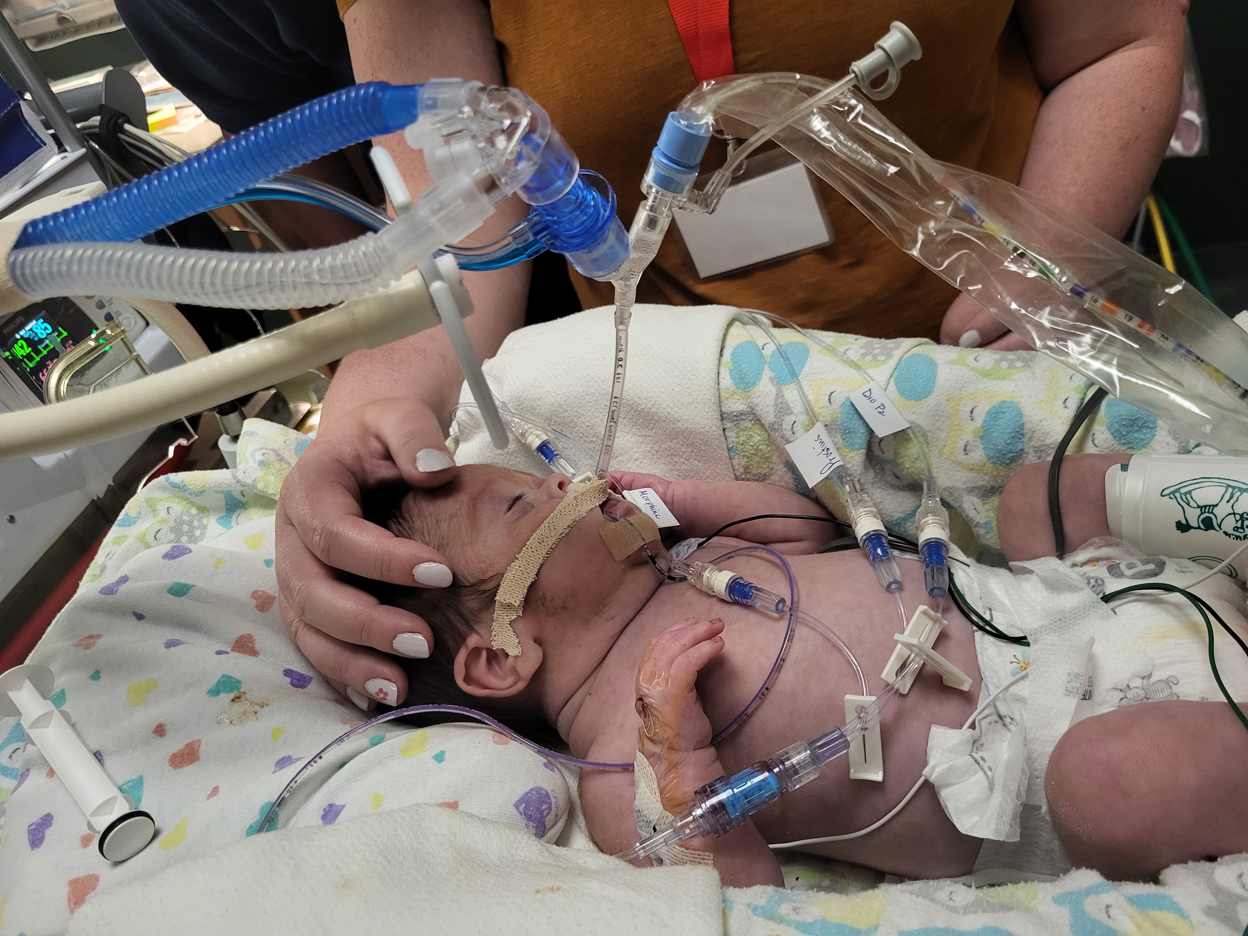 Hope Starts Here: Support Baby Rory’s Journey campaign photo, 4 of 7