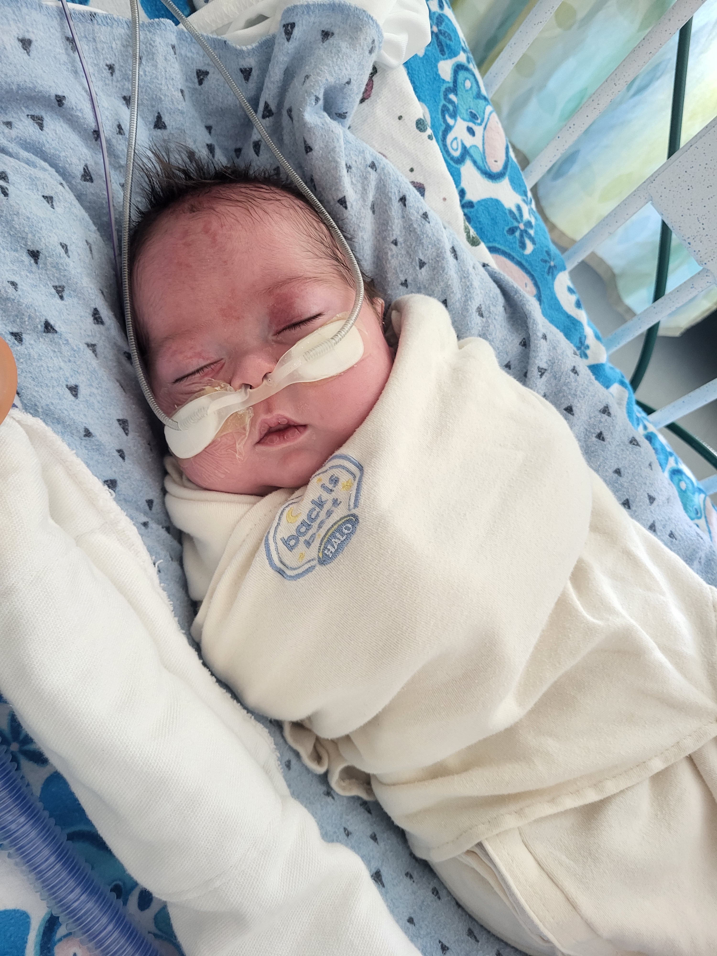 Hope Starts Here: Support Baby Rory’s Journey campaign photo, 5 of 7