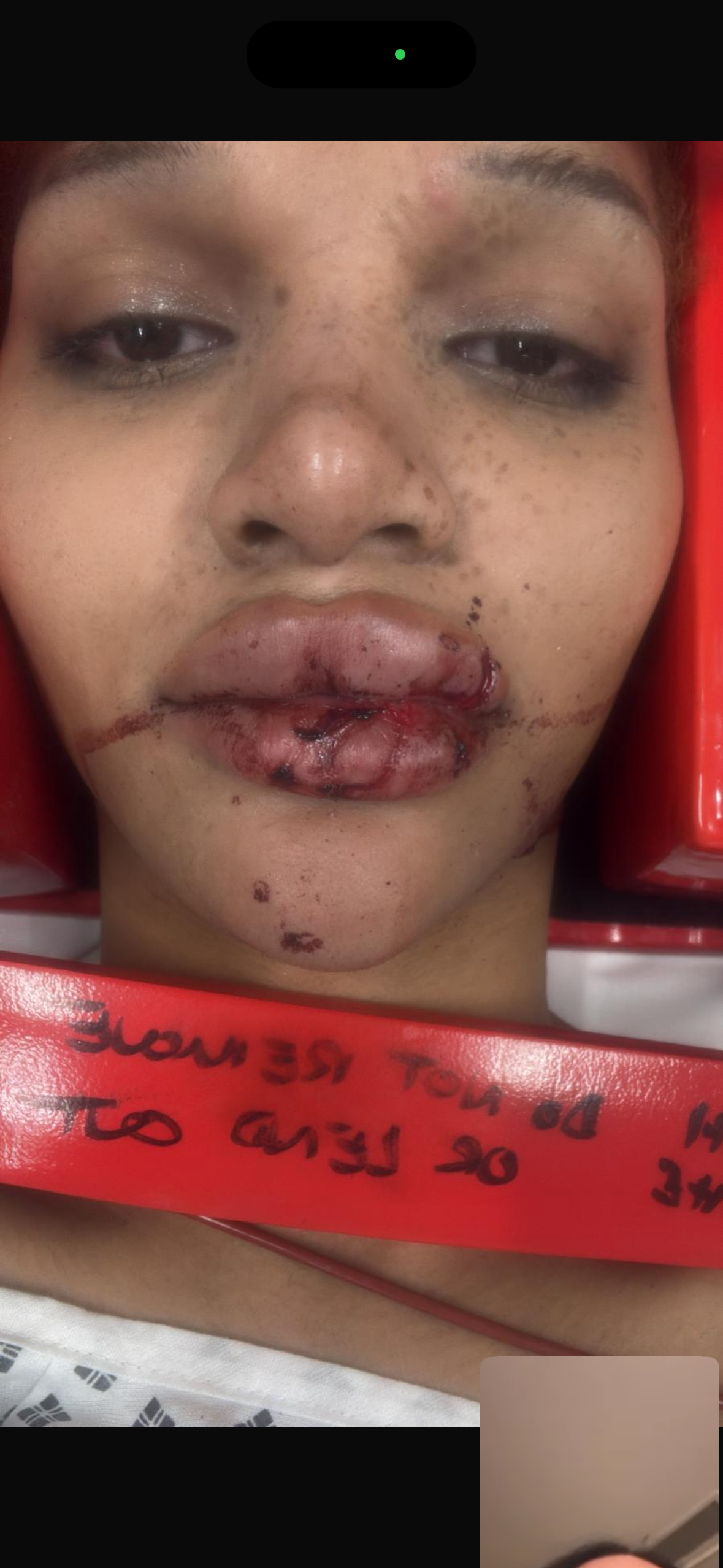 SURVIVAL FUND AFTER VIOLENT ATTACK ON TRANS WOMAN campaign photo, 2 of 4
