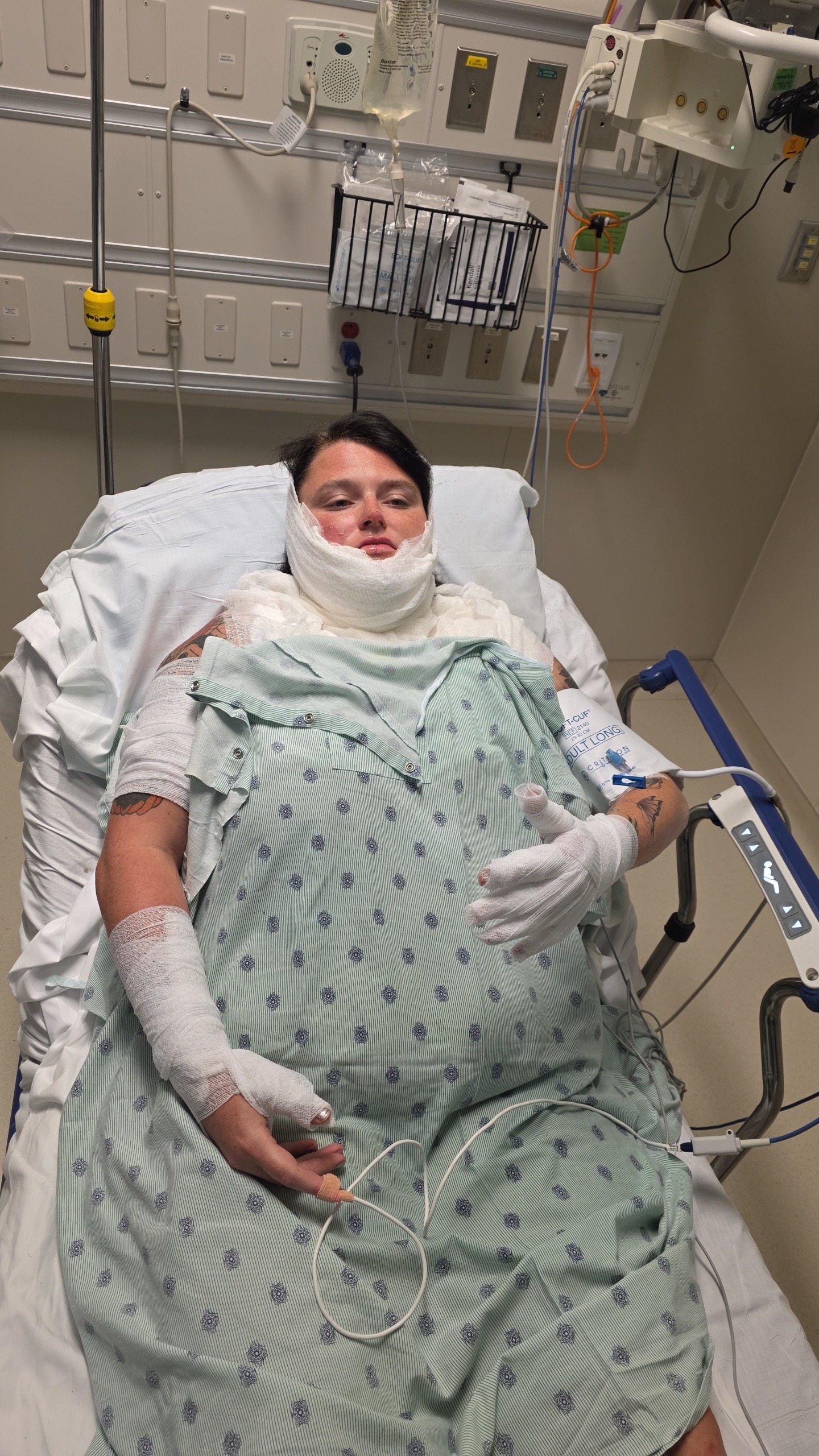 Support Destiny's Burn Recovery Journey campaign photo, 4 of 7