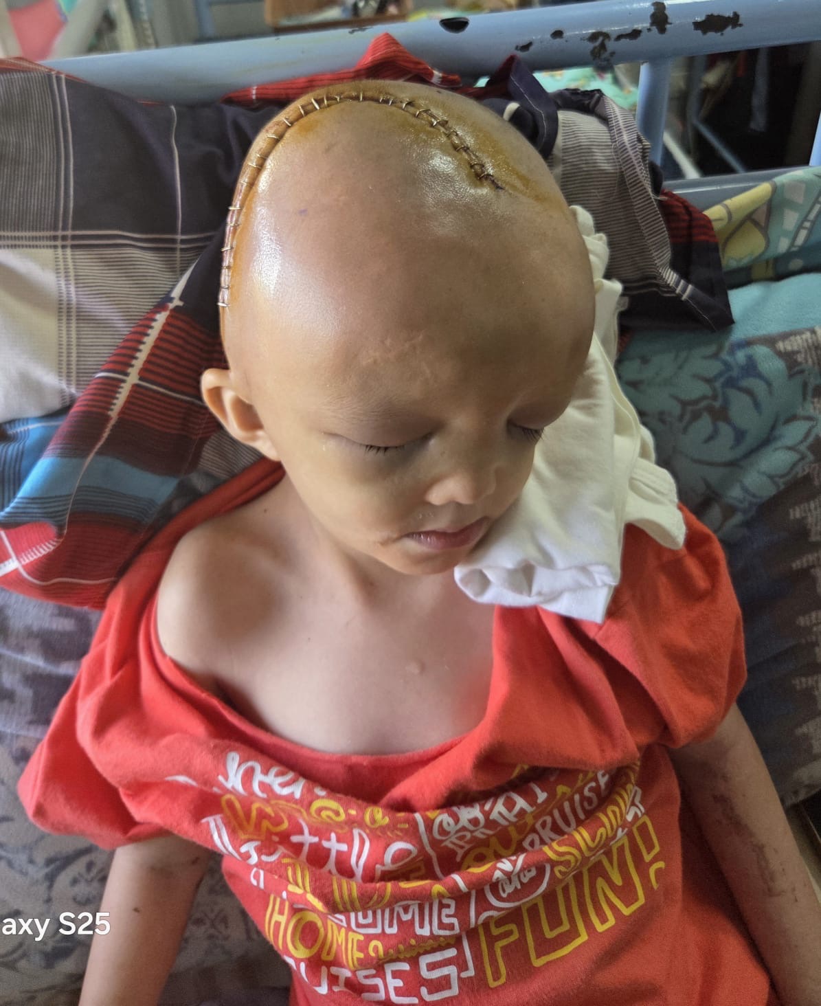 Help Nicholas Recover After Life-Saving Brain Surgery campaign photo, 2 of 4
