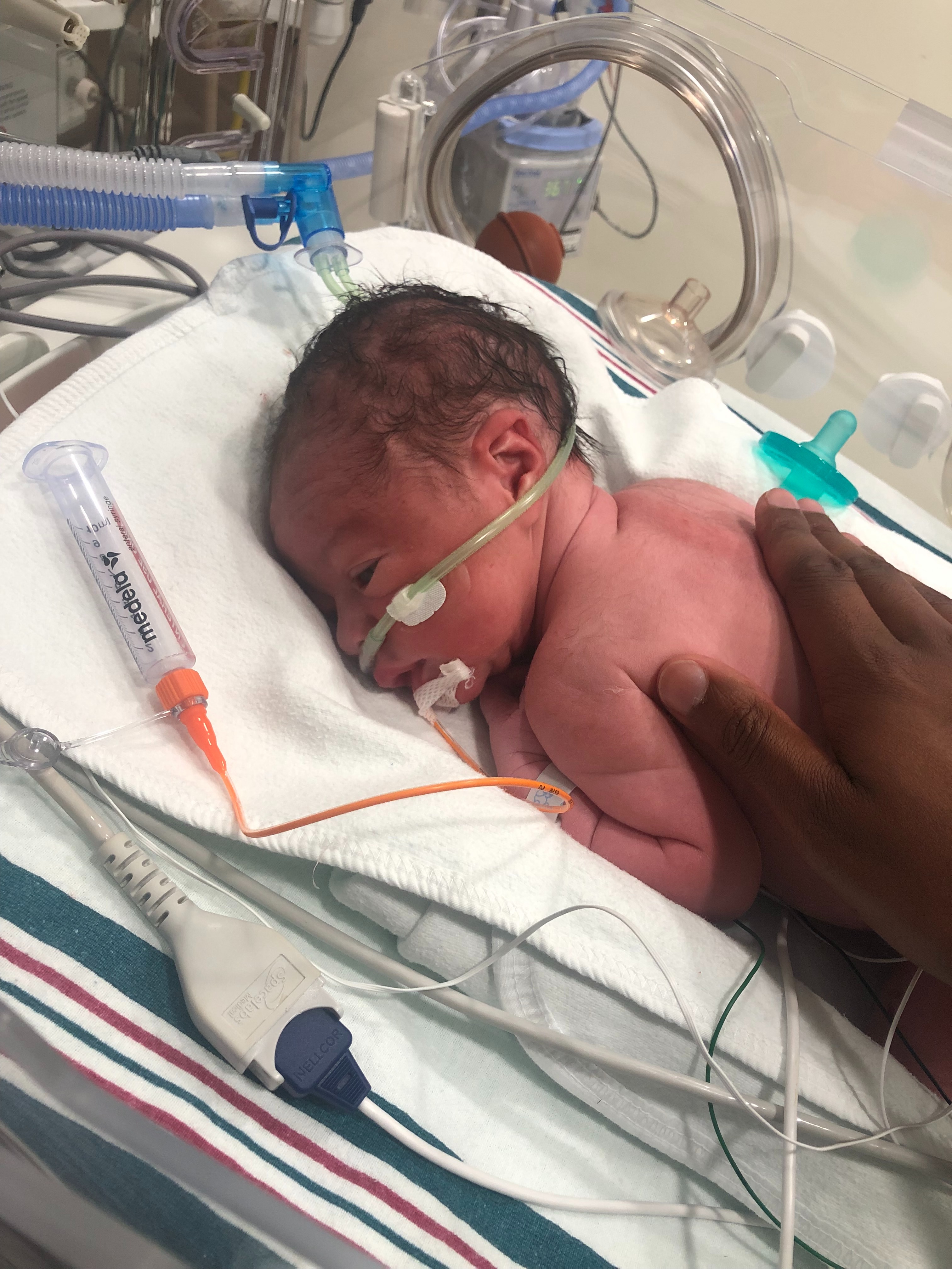Cover Judah's NICU Visit and Mama's unforeseen medical bills campaign photo, 2 of 5