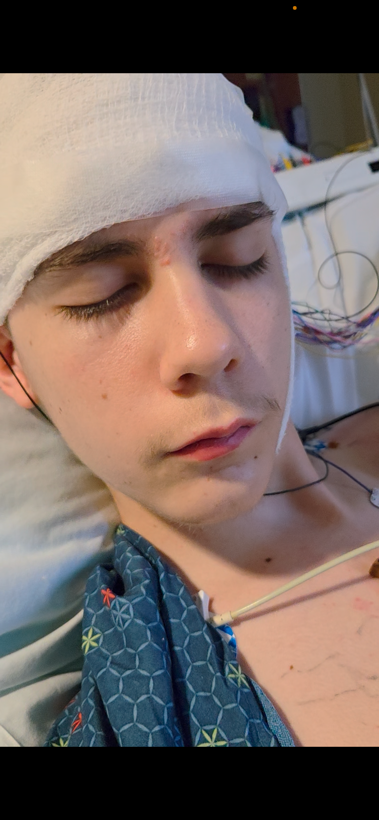Jakob's Journey: Next steps and updates for his healing. campaign photo, 6 of 7