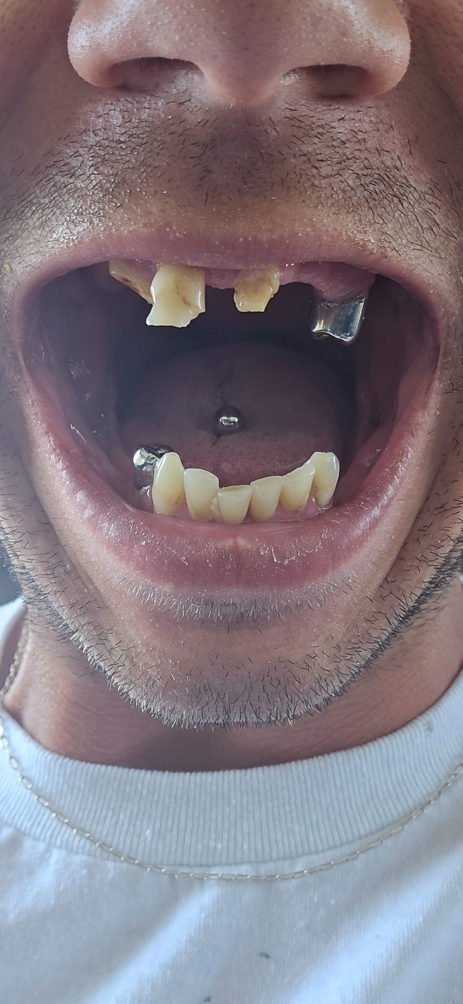 AyJay's Tooth Pain Relief campaign photo, 2 of 5