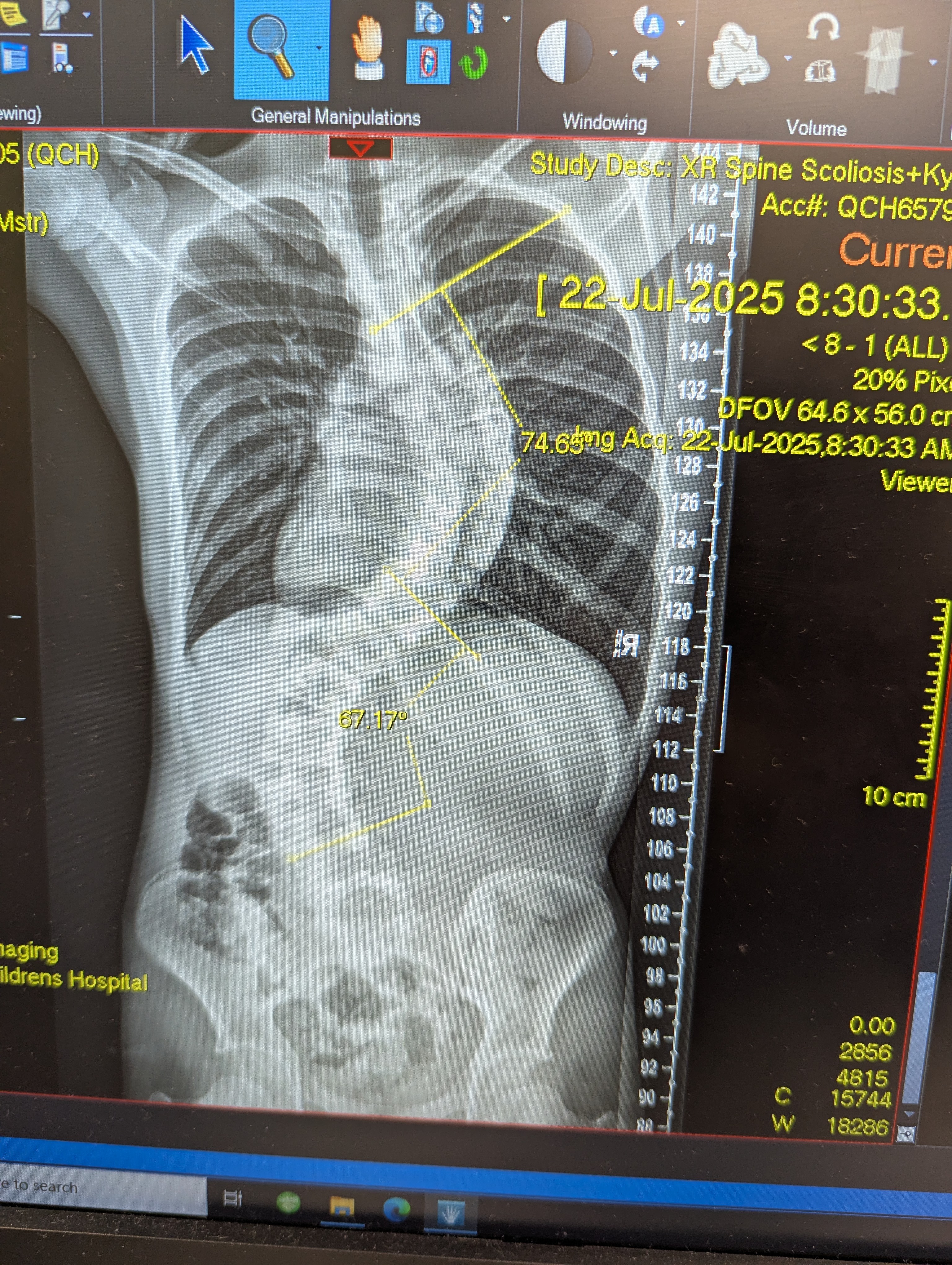 Help us with the surgery, physio, home schooling and care campaign photo, 2 of 4