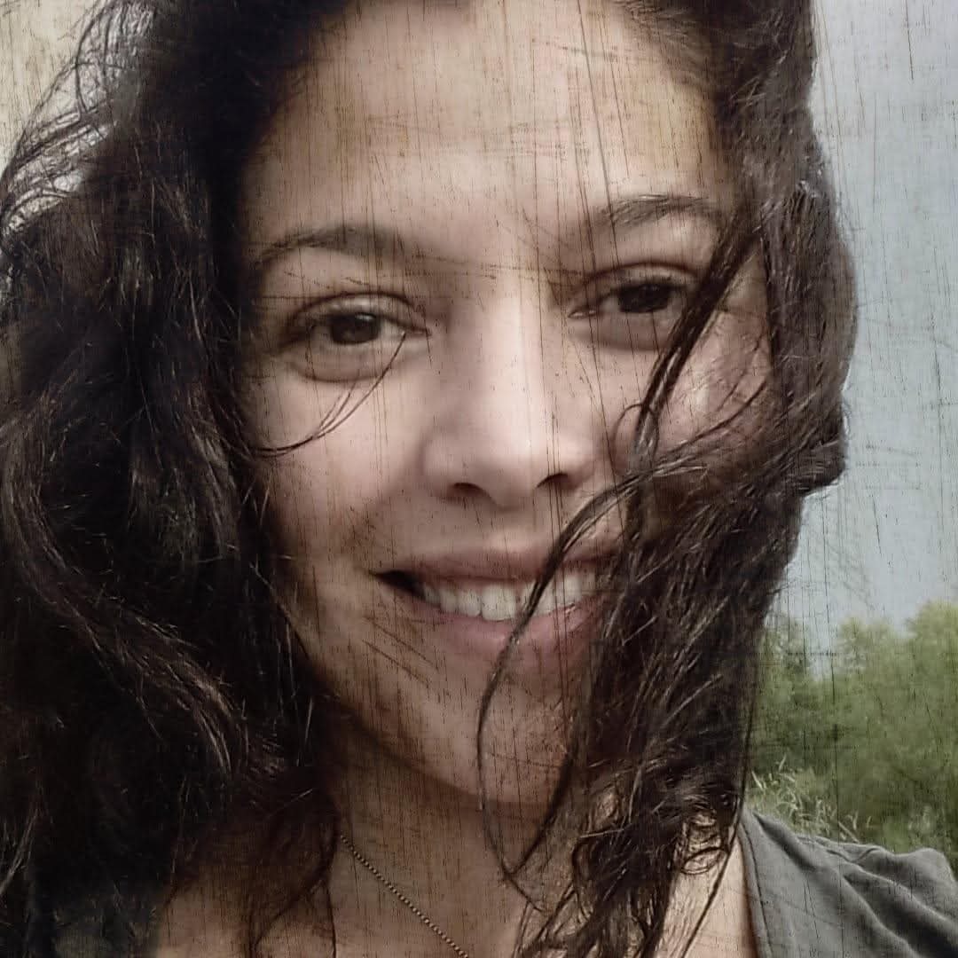 Help Ale with her surgery for her shattered arm campaign photo, 2 of 5