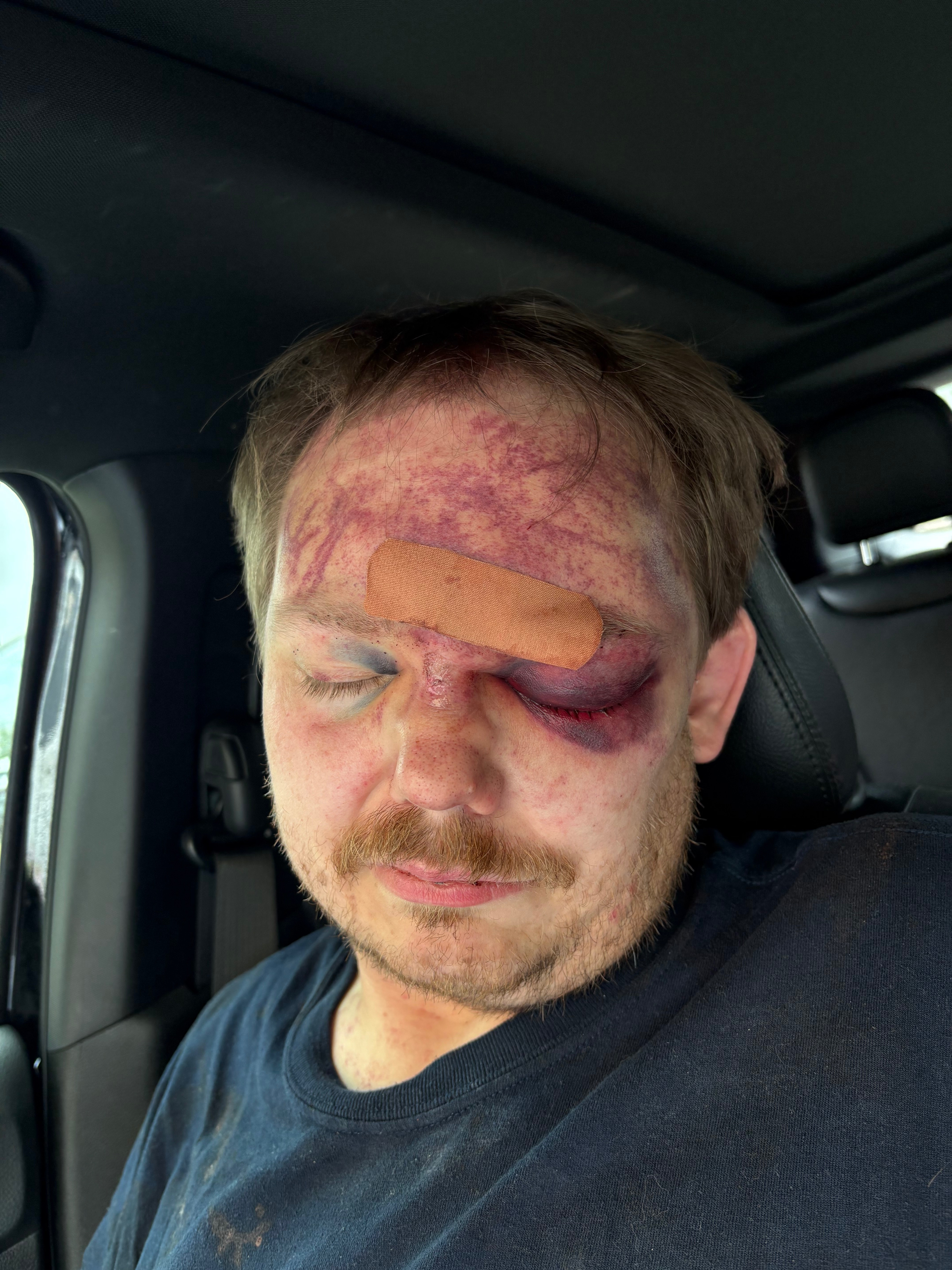 Help Jason Cooper Recover from Brutal Assault campaign photo, 6 of 7